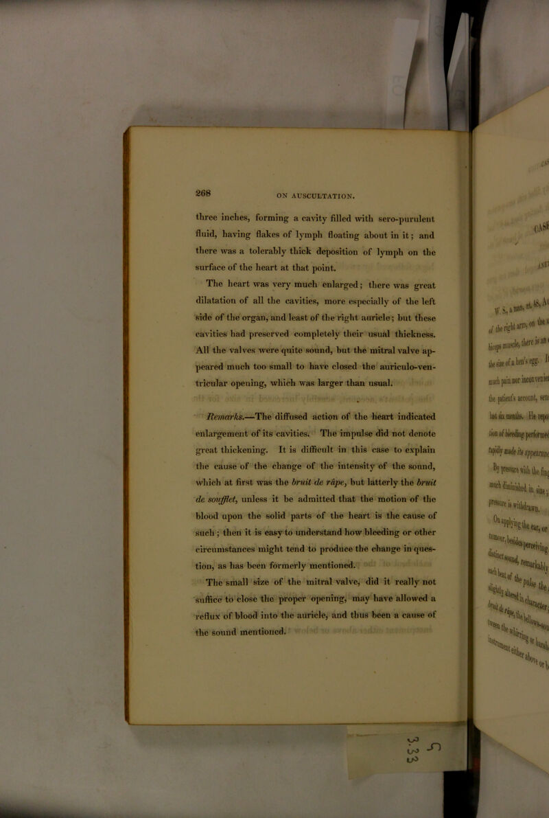 ON AUSCULTATION. three inches, forming a cavity filled with sero-purulent fluid, having flakes of lymph floating about in it; and there was a tolerably thick deposition of lymph on the surface of the heart at that point. The heart was very much enlarged; there was gi-eat dilatation of all the cavities, more especially of the left side of the organ, and least of the right auricle; but these cavities had preserved completely their usual thickness. All the valves were quite sound, but the mitral valve ap- peared much too small to haA-^e closed the auriculo-ven- tricular opening, which was larger than usual. ■' Remarks.—The diffused action of the heart indicated enlargement of its cavities. The impulse did not denote great thickening. It is diflficult in this case to explain the cause of the change of the intensity of the sound, which at first was the bruit de rape, but latterly the bruit de soufflet, unless it be admitted that the motion of the blood upon the solid parts of the heart is the cause of such ; then it is easy to understand how bleeding or other circumstances might tend to produce the change in ques- tion, as has been formerly mentioned. The small size of the mitral valve, did it really not suffice to close the proper opening, may have allowed a reflux of blood into the auricle, and thus been a cause of the sound mentioned.' trO