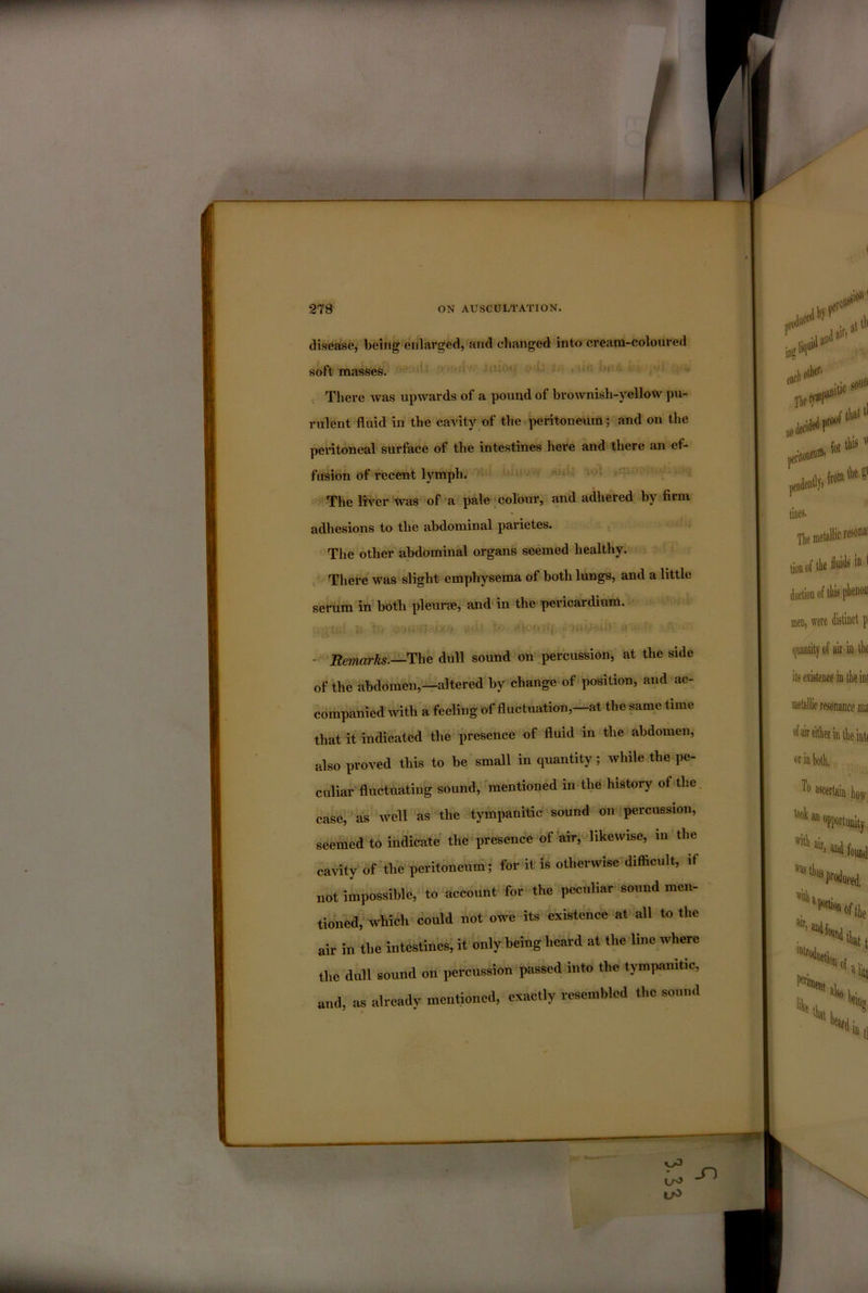 disease, being enlarged, and changed into cream-coloured soft masses. JiiitKi 'u ; •r'' .. There was upwards of a pound of brownisli-yellow pu- rulent fluid in the cavity of the peritoneum: and on the pei-itoneal surface of the intestines here and there an ef- fusion of recent lymph. iOi .m-;? '^ The lirs'^er was of a pale 'colour, and adhered by firm adhesions to the abdominal parietes. The other abdominal organs seemed healthy. ^ There was slight emphysema of both lungs, and a little serum in both pleurae, and in the pericardium. - JiemirJis.—The dull sound on percussion, at the side of the abdomen,—altered by change of position, and ac- companied with a feeling of fluctuation,—at the same time that It indicated the presence ^of fluid in the abdomen, also proved this to be small in quantity; while the pe- culiar fluctuating sound, 'mentioned in the history of the case, ‘as well as the tympanitic sound on percussion, seemed to indicate the presence of air, >likewise, in the cavity of the peritoneum; for it is otherwise difficult, if not impossible, to account for the peculiar sound men- tioned; which could not owe its existence at all to the air in the intestines; it only being heard at the line where the dull sound on percussion passed into the tympanitic, and, as already mentioned, exactly resembled the sound