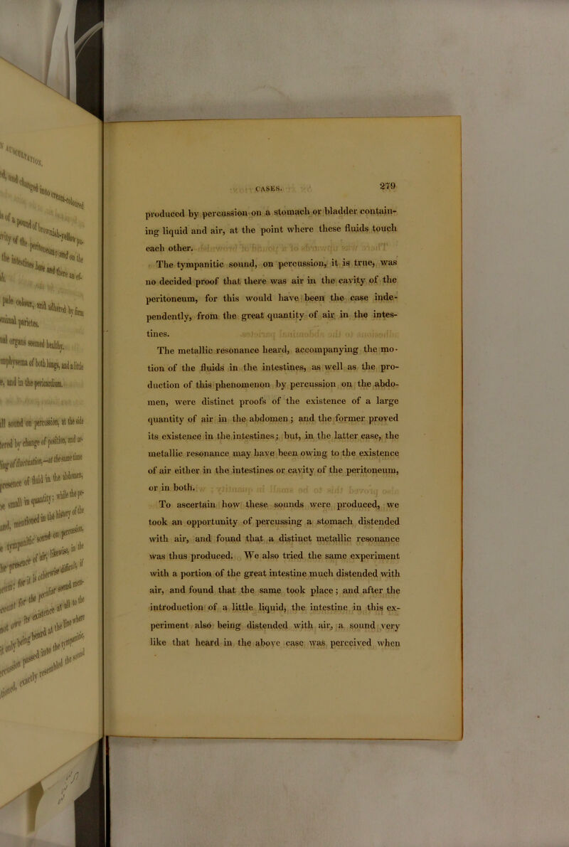 produced by percussion-'on a stoniacb or bladder contain- ing liquid and air, at the point where these fluitls touch each other. The tympanitic sound, on percussion, it is true,, was no decided proof that there was air in the cavity of the peritoneum, for this would have been the case inde- pendently, from the great quantity of air in the intes- tines. H: LI The metallic resonance heard, accompanying the mo- tion of the fluids ini,the intestines, as well as the pro- duction of this phenomenon by percussion, on the abdo- men, were distinct proofs of the existence of a large quantity of air in the abdomen; and the former proved its existence in the intestines j but, in the latter case, the metallic resonance may have been owing to the existence of air either in the intestines or cavity of the peritoneum, or in both. To ascertain how these sounds were produced, we took an opportunity of percussing a stomach distended with air, and found that a distinct metallic resonance was thus produced. We also tried the same experiment with a portion of the great intestine much distended with air, and found that the same took place; and after the introduction of a little liquid, the intestine in this ex- periment also being distended with air, a sound very like that heard in the above case was perceived when