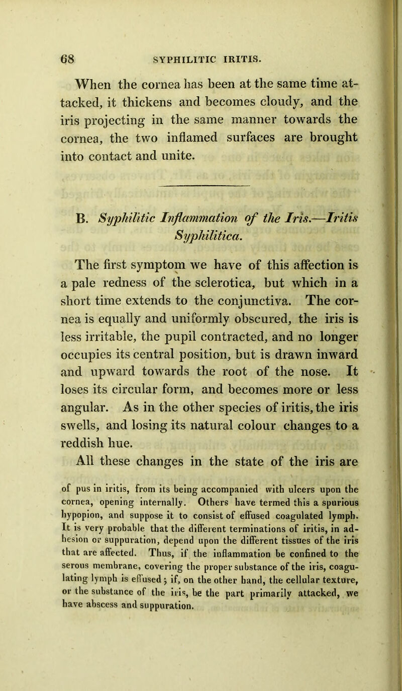 When the cornea has been at the same time at- tacked, it thickens and becomes cloudy, and the iris projecting in the same manner towards the cornea, the two inflamed surfaces are brought into contact and unite. B. Syphilitic Inflammation of the Iris.—Iritis Syphilitica. The first symptom we have of this affection is a pale redness of the sclerotica, but which in a short time extends to the conjunctiva. The cor- nea is equally and uniformly obscured, the iris is less irritable, the pupil contracted, and no longer occupies its central position, but is drawn inward and upward towards the root of the nose. It loses its circular form, and becomes more or less angular. As in the other species of iritis, the iris swells, and losing its natural colour changes to a reddish hue. All these changes in the state of the iris are of pus in iritis, from its being accompanied with ulcers upon the cornea, opening internalb. Others have termed this a spurious hypopion, and suppose it to consist of effused coagulated lymph. It is very probable that the different terminations of iritis, in ad- hesion or suppuration, depend upon the different tissues of the iris that are affected. Thus, if the inflammation be confined to the serous membrane, covering the proper substance of the iris, coagu- lating lymph is effused j if, on the other hand, the cellular texture, or the substance of the iris, be the part primarily attacked, we have abscess and suppuration.