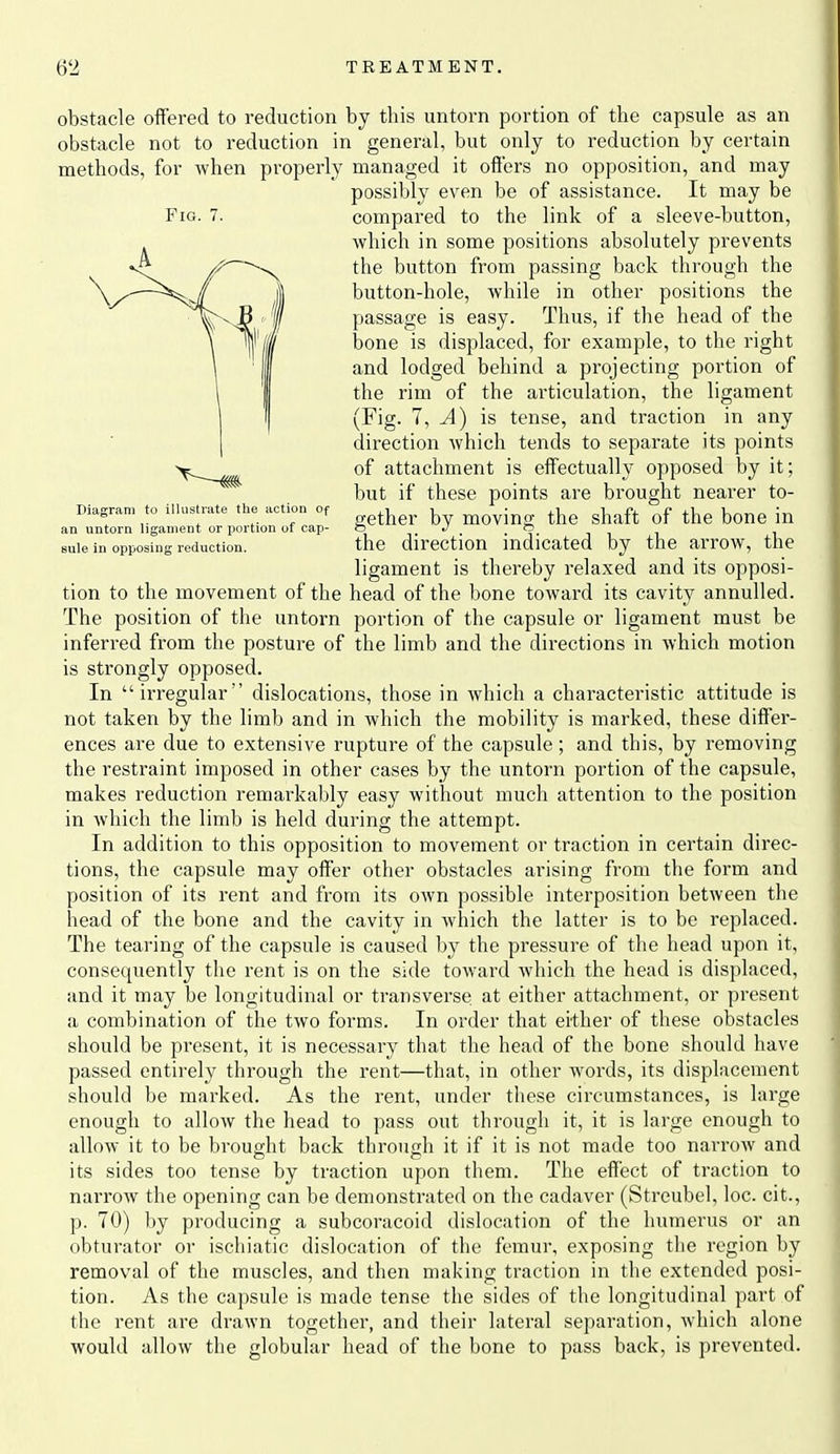 Fig. 7. Diagram to illustrate tlie action Of an untorn ligament or portion of cap- sule in opposing reduction. obstacle offered to reduction by this untorn portion of the capsule as an obstacle not to reduction in general, but only to reduction by certain methods, for when properly managed it offers no opposition, and may possibly even be of assistance. It may be compared to the link of a sleeve-button, which in some positions absolutely prevents the button from passing back through the button-hole, while in other positions the passage is easy. Thus, if the head of the bone is displaced, for example, to the right and lodged behind a projecting portion of the rim of the articulation, the ligament (Fig. 7, ^) is tense, and traction in any direction which tends to separate its points of attachment is effectually opposed by it; but if these points are brought nearer to- gether by moving the shaft of the bone in the direction indicated by the arrow, the ligament is thereby relaxed and its opposi- tion to the movement of the head of the bone toward its cavity annulled. The position of the untorn portion of the capsule or ligament must be inferred from the posture of the limb and the directions in which motion is strongly opposed. In irregular dislocations, those in which a characteristic attitude is not taken by the limb and in which the mobility is marked, these differ- ences are due to extensive rupture of the capsule ; and this, by removing the restraint imposed in other cases by the untorn portion of the capsule, makes reduction remarkably easy without much attention to the position in which the limb is held during the attempt. In addition to this opposition to movement or traction in certain direc- tions, the capsule may offer other obstacles arising from the form and position of its rent and from its own possible interposition between the head of the bone and the cavity in which the latter is to be replaced. The tearing of the capsule is caused by the pressure of the head upon it, consequently the rent is on the side toward which the head is displaced, and it may be longitudinal or transverse at either attachment, or present a combination of the two forms. In order that either of these obstacles should be present, it is necessary that the head of the bone should have passed entirely through the rent—that, in other words, its displacement should be marked. As the rent, under these circumstances, is large enough to allow the head to pass out through it, it is large enough to allow it to be brought back through it if it is not made too narrow and its sides too tense by traction upon them. The effect of traction to narrow the opening can be demonstrated on the cadaver (Streubel, loc. cit., p. 70) by producing a subcoracoid dislocation of the humerus or an obturator or ischiatic dislocation of the femur, exposing the region by removal of the muscles, and then making traction in the extended posi- tion. As the capsule is made tense the sides of the longitudinal part of the rent are drawn together, and their lateral separation, which alone would allow the globular head of the bone to pass back, is prevented.