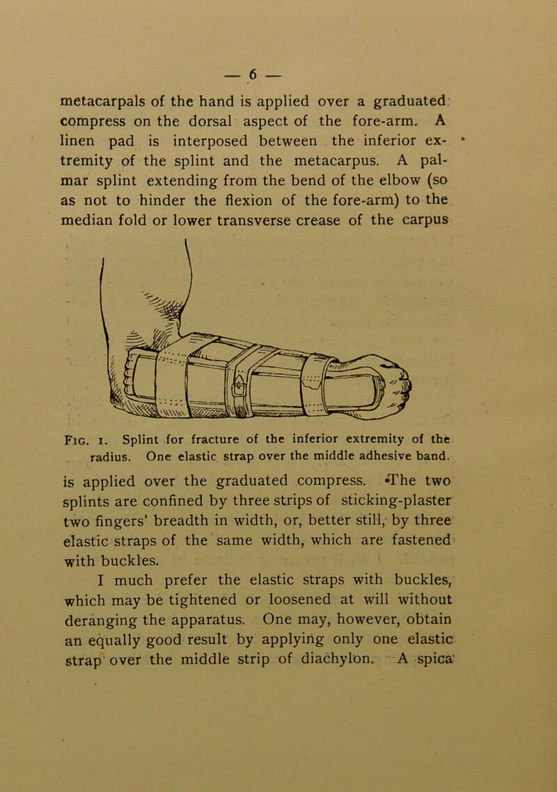 metacarpals of the hand is applied over a graduated; compress on the dorsal aspect of the fore-arm. A linen pad is interposed between the inferior ex- • tremity of the splint and the metacarpus, A pal- mar splint extending from the bend of the elbow (so as not to hinder the flexion of the fore-arm) to the median fold or lower transverse crease of the carpus Fig. I. Splint for fracture of the inferior extremity of the radius. One elastic strap over the middle adhesive band. is applied over the graduated compress. fThe two splints are confined by three strips of sticking-plaster two fingers’ breadth in width, or, better still, by three elastic straps of the same width, which are fastened with buckles. I much prefer the elastic straps with buckles, which may be tightened or loosened at will without deranging the apparatus. One may, however, obtain an equally good result by applying only one elastic strap'over the middle strip of diachylon. A spica'