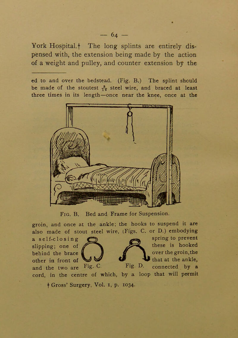 York Hospital.! The long splints are entirely dis- pensed with, the extension being made by the action of a weight and pulley, and counter extension by the ed to and over the bedstead. (Fig. B.) The splint should be made of the stoutest steel wire, and braced at least three times in its length—once near the knee, once at the Fig. B. Bed and Frame for Suspension. groin, and once at the ankle; the hooks to suspend it are also made of stout steel wire, (Figs. C. or D.) embodying a self-closing slipping; one of behind the brace other in front of and the two are ^ A spring to prevent these is hooked over the groin,the that at the ankle, connected by a cord, in the centre of which, by a loop that will permit f Gross’ Surgery, Vol. i, p. 1034.