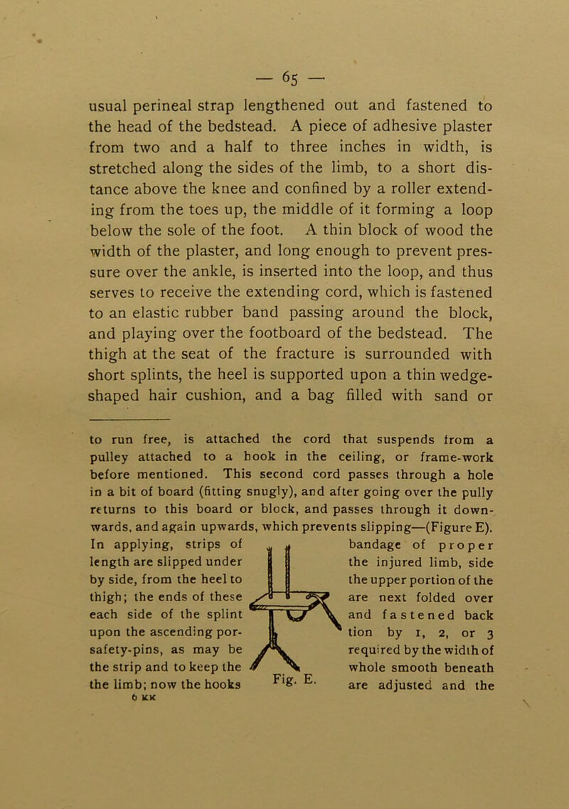 usual perineal strap lengthened out and fastened to the head of the bedstead. A piece of adhesive plaster from two and a half to three inches in width, is stretched along the sides of the limb, to a short dis- tance above the knee and confined by a roller extend- ing from the toes up, the middle of it forming a loop below the sole of the foot. A thin block of wood the width of the plaster, and long enough to prevent pres- sure over the ankle, is inserted into the loop, and thus serves to receive the extending cord, which is fastened to an elastic rubber band passing around the block, and playing over the footboard of the bedstead. The thigh at the seat of the fracture is surrounded with short splints, the heel is supported upon a thin wedge- shaped hair cushion, and a bag filled with sand or to run free, is attached the cord that suspends from a pulley attached to a hook in the ceiling, or frame-work before mentioned. This second cord passes through a hole in a bit of board (fitting snugly), and after going over the pully returns to this board or block, and passes through it down- wards, and again upwards, which prevents slipping—(Figure E). In applying, strips of length are slipped under by side, from the heel to thigh; the ends of these each side of the splint upon the ascending por- safety-pins, as may be the strip and to keep the the limb; now the hooks 6 KK Fig. E. bandage of proper the injured limb, side the upper portion of the are next folded over and fastened back tion by i, 2, or 3 required by the width of whole smooth beneath are adjusted and the