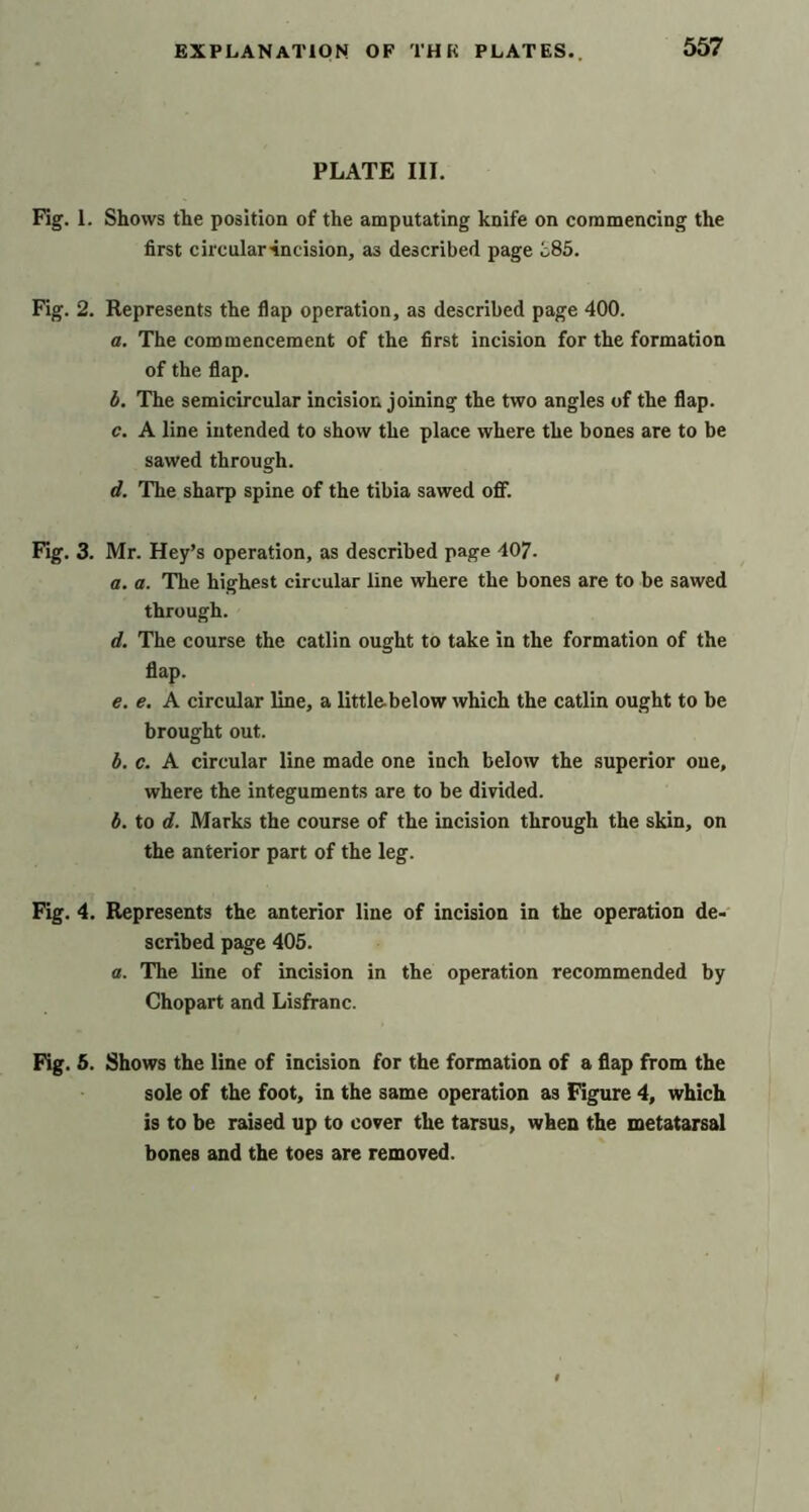 PLATE III. Fig. 1. Shows the position of the amputating knife on commencing the first circular'incision, as described page i.85. Fig. 2. Represents the flap operation, as described page 400. a. The commencement of the first incision for the formation of the flap. b. The semicircular incision joining the two angles of the flap. c. A line intended to show the place where the bones are to be sawed through. d. The sharp spine of the tibia sawed off. Fig. 3. Mr. Key’s operation, as described page 407. a. a. The highest circular line where the bones are to be sawed through. d. The course the catlin ought to take in the formation of the flap. e. e. A circular line, a littl&below which the catlin ought to be brought out. b. c. A circular line made one inch below the superior oue, where the integuments are to be divided. b. to d. Marks the course of the incision through the skin, on the anterior part of the leg. Fig. 4. Represents the anterior line of incision in the operation de- scribed page 405. a. The line of incision in the operation recommended by Chopart and Lisfranc. Fig. 5. Shows the line of incision for the formation of a flap from the sole of the foot, in the same operation as Figure 4, which is to be raised up to cover the tarsus, when the metatarsal bones and the toes are removed.