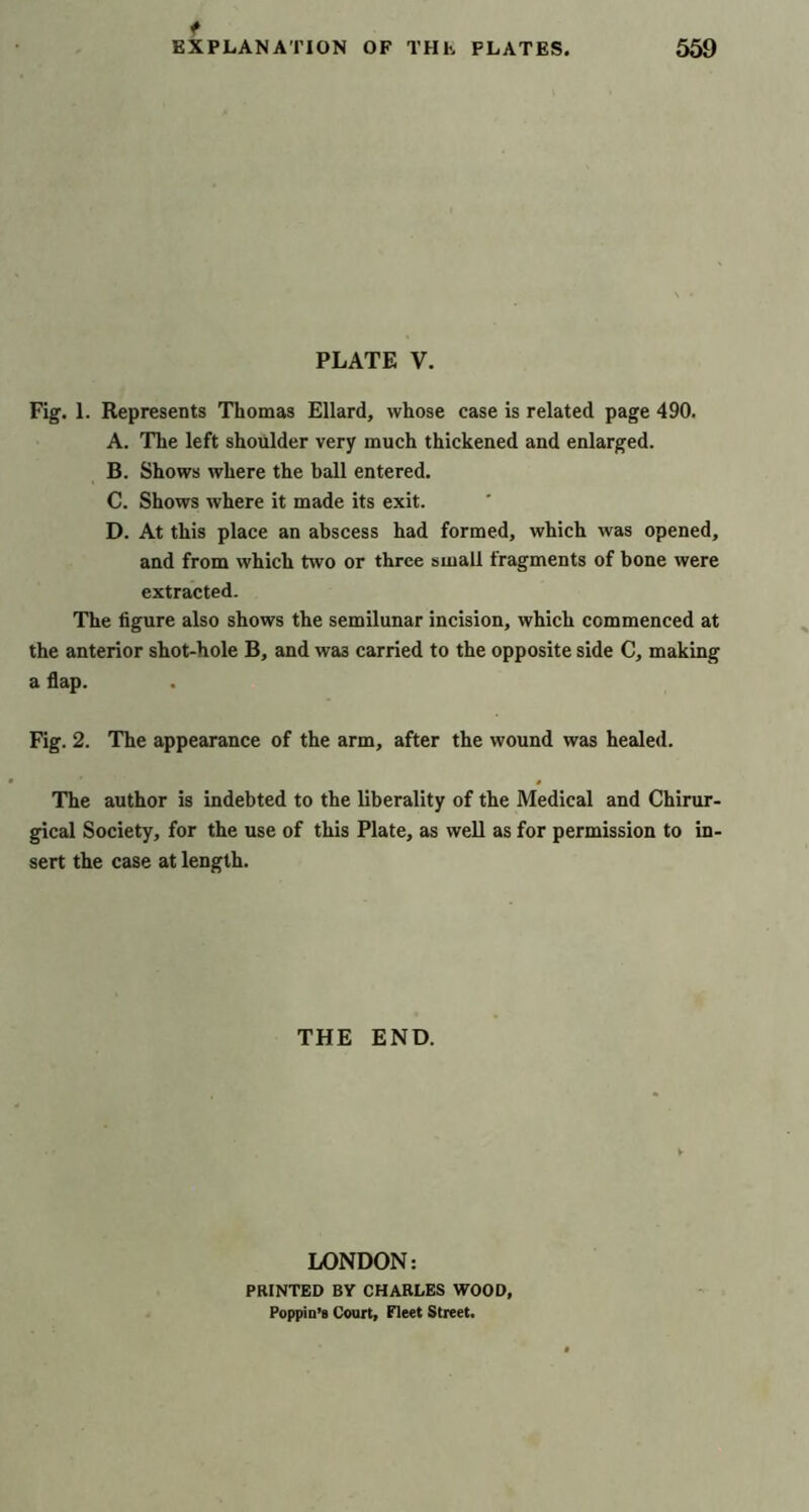 PLATE V. Fig. 1. Represents Thomas Ellard, whose case is related page 490. A. The left shoulder very much thickened and enlarged. B. Shows where the ball entered. C. Shows where it made its exit. D. At this place an abscess had formed, which was opened, and from which two or three small fragments of bone were extracted. The figure also shows the semilunar incision, which commenced at the anterior shot-hole B, and was carried to the opposite side C, making a flap. Fig. 2. The appearance of the arm, after the wound was healed. The author is indebted to the liberality of the Medical and Chirur- gical Society, for the use of this Plate, as weU as for permission to in- sert the case at length. THE END. LONDON: PRINTED BY CHARLES WOOD, PoppiD’g Court, Fleet Street.