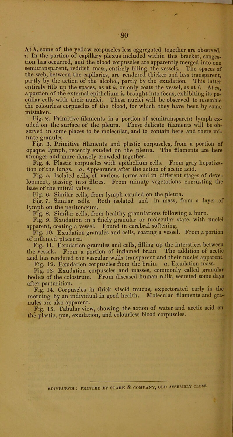At /t, some of the yellow corpuscles less aggregated together are observed. In the portion of capillary plexus included within this bracket, conges- tion has occurred, and the blood corpuscles are apparently merged into one semitransparent, reddish mass, entirely filling the vessels. The spaces of the web, between the capllaries, are rendered thicker and less transparent, partly by the action of the alcohol, partly by the exudation. This latter entirely fills up the spaces, as at k, or only coats the vessel, as at /. At m, a portion of the external epithelium is brought into focus, exhibiting its pe- culiar cells with their nuclei. These nuclei will be observed to resemble the colourless corpuscles of the blood, for which they have been by some mistaken. Fig. 2. Primitive filaments in a portion of semitransparent lymph ex- uded on the surface of the pleura. These delicate filaments will be ob- served in some places to be molecular, and to contain here and there mi- nute granules. Fig. 3. Primitive filaments and plastic corpuscles, from a portion of opaque lymph, recently exuded on the pleura. The filaments are here stronger and more densely crowded together. Fig. 4. Plastic corpuscles with epithelium cells. From gray hepatiza- tion of the lungs, a. Appearance-after the action of acetic acid. Fig. 5. Isolated cells, of various forms and in different stages of deve- lopment, passing into fibres. From minute vegetations encrusting the base of the mitral valve. Fig. 6. Similar cells, from lymph exuded on the pleura. Fig. 7. Similar cells- Both isolated and in mass, from a layer of lymph on the peritomeum. Fig. 8. Similar cells, from healthy granulations following a burn. Fig. 9. Exudation in a finely granular or molecular state, with nuclei apparent, coating a vessel. Found in cerebral softening. Fig. 10. Exudation granules and cells, coating a vessel. From a portion of inflamed placenta. Fig. 11. Exudation granules and cells, filling up the interstices between the vessels. From a portion of inflamed brain. The addition of acetic acid has rendered the vascular walls transparent and their nuclei apparent. Fig- 12. Exudation corpuscles from the brain, a. Exudation mass. Fig. 13. Exudation corpuscles and masses, commonly called granular bodies of the colostrum. From diseased human milk, secreted some days after parturition. Fig. 14. Corpuscles in thick viscid mucus, expectorated early in the morning by an individual in good health. Molecular filaments and gra- nules are also apparent. Fig. 15. Tabular view, showing the action of water and acetic acid on the plastic, pus, exudation, and colourless blood corpuscles. EDINBURGH I TRINTBD BY STARK & COMPANY, OLD ASSEMBLY CLOSE.