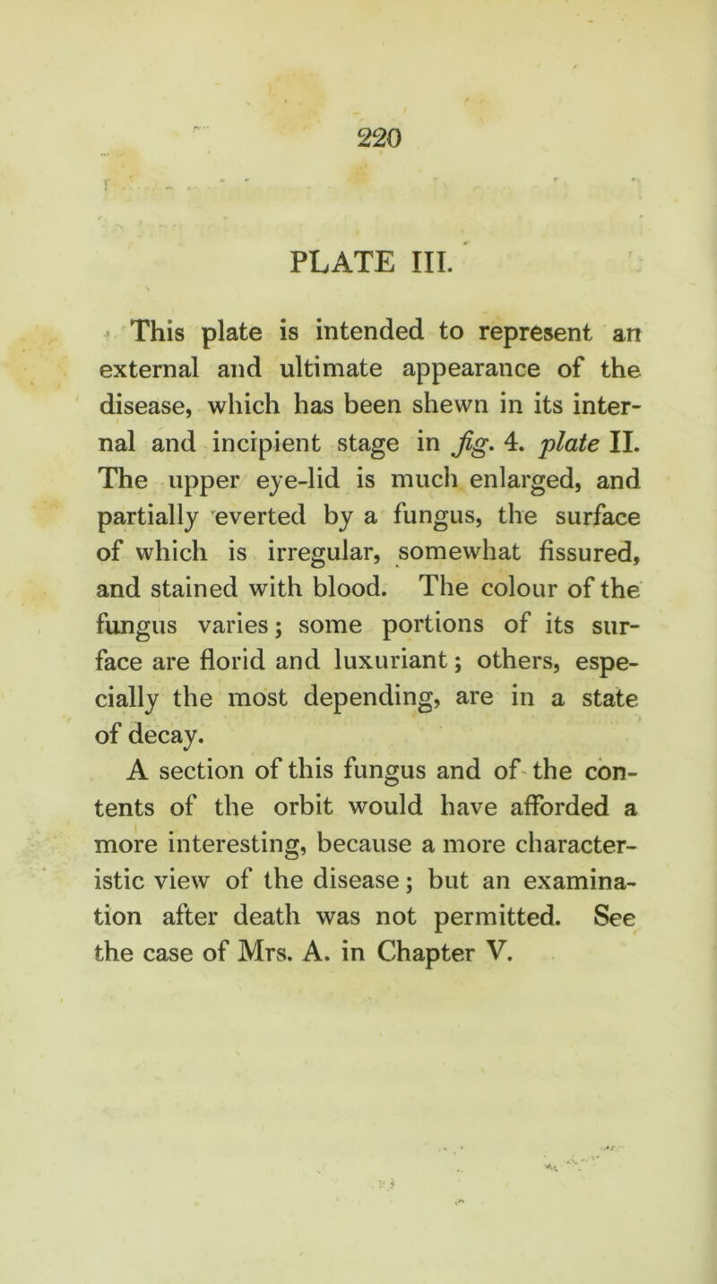 r-.-. ... -v r PLATE III. This plate is intended to represent an external and ultimate appearance of the disease, which has been shewn in its inter- nal and incipient stage in jig. 4. plate II. The upper eye-lid is much enlarged, and partially everted by a fungus, the surface of which is irregular, somewhat fissured, and stained with blood. The colour of the fungus varies; some portions of its sur- face are florid and luxuriant; others, espe- cially the most depending, are in a state of decay. A section of this fungus and of the con- tents of the orbit would have afforded a more interesting, because a more character- istic view of the disease; but an examina- tion after death was not permitted. See the case of Mrs. A. in Chapter V.