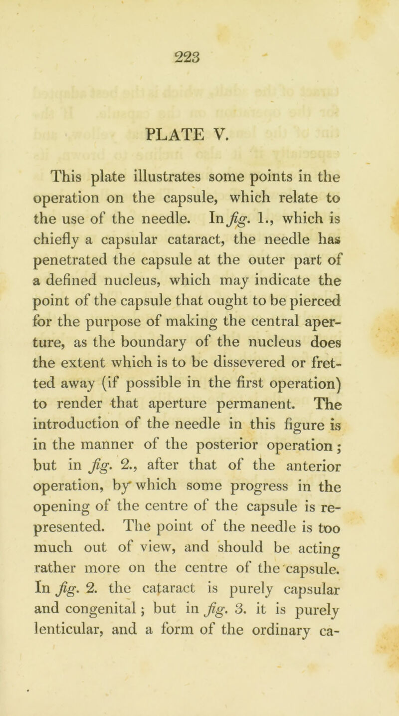 PLATE V. This plate illustrates some points in the operation on the capsule, which relate to the use of the needle. In Jig. 1., which is chiefly a capsular cataract, the needle has penetrated the capsule at the outer part of a defined nucleus, which may indicate the point of the capsule that ought to be pierced for the purpose of making the central aper- ture, as the boundary of the nucleus does the extent which is to be dissevered or fret- ted away (if possible in the first operation) to render that aperture permanent. The introduction of the needle in this figure is in the manner of the posterior operation; but in Jig. 2., after that of the anterior operation, by* which some progress in the opening of the centre of the capsule is re- presented. The point of the needle is too much out of view, and should be acting rather more on the centre of the capsule. In Jig. 2. the cataract is purely capsular and congenital; but in Jig. 3. it is purely lenticular, and a form of the ordinary ca-