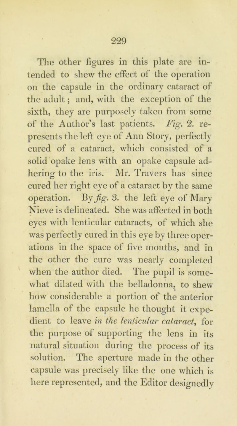 The other figures in this plate are in- tended to shew the effect of the operation on the capsule in the ordinary cataract of the adult; and, with the exception of the sixth, they are purposely taken from some of the Author’s last patients. Fig. 2. re- presents the left eye of Ann Story, perfectly cured of a cataract, which consisted of a solid opake lens with an opake capsule ad- hering to the iris. Mr. Travers has since cured her right eye of a cataract by the same operation. By Jig. 3. the left eye of Mary Nieve is delineated. She was affected in both eyes with lenticular cataracts, of which she was perfectly cured in this eye by three oper- ations in the space of five months, and in the other the cure was nearly completed when the author died. The pupil is some- what dilated with the belladonna, to shew how considerable a portion of the anterior lamella of the capsule he thought it expe- dient to leave in the lenticular cataract, for the purpose of supporting the lens in its natural situation during the process of its solution. The aperture made in the other capsule was precisely like the one which is here represented, and the Editor designedlv