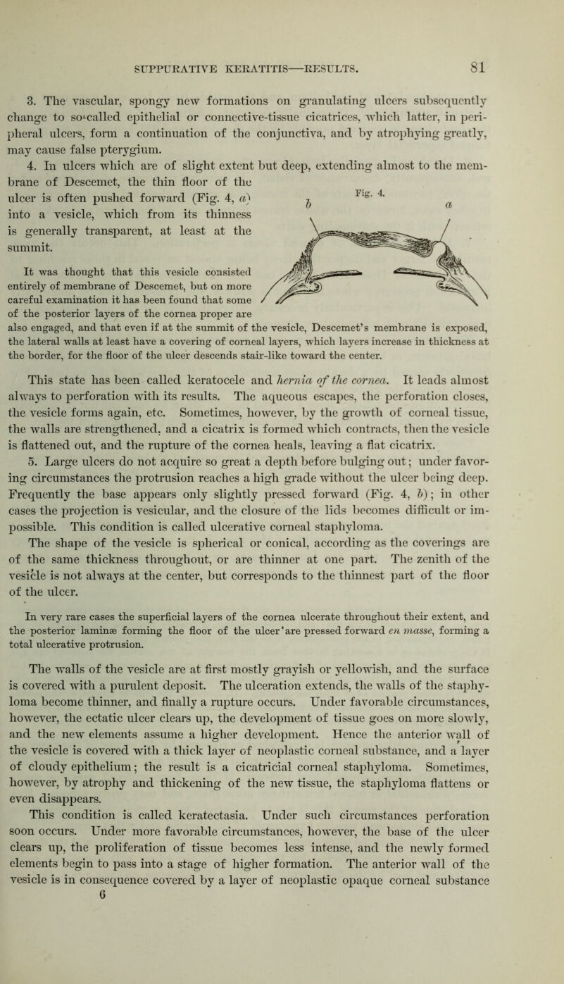 3. The vascular, spongy new formations on granulating ulcers subsequently change to so-called epithelial or connective-tissue cicatrices, which latter, in peri- pheral ulcers, form a continuation of the conjunctiva, and by atrophying greatly, may cause false pterygium. 4. In ulcers which are of slight extent but deep, extending almost to the mem- brane of Descemet, the thin floor of the ulcer is often pushed forward (Fig. 4, a) into a vesicle, which from its thinness is generally transparent, at least at the summit. It was thought that this vesicle consisted entirely of membrane of Descemet, but on more careful examination it has been found that some of the posterior layers of the cornea proper are also engaged, and that even if at the summit of the vesicle, Descemet’s membrane is exposed, the lateral walls at least have a covering of corneal layers, which layers increase in thickness at the border, for the floor of the ulcer descends stair-like toward the center. This state has been called keratocele and hernia of the cornea. It leads almost always to perforation with its results. The aqueous escapes, the perforation closes, the vesicle forms again, etc. Sometimes, however, by the growth of corneal tissue, the walls are strengthened, and a cicatrix is formed which contracts, then the vesicle is flattened out, and the rupture of the cornea heals, leaving a flat cicatrix. 5. Large ulcers do not acquire so great a depth before bulging out; under favor- ing circumstances the protrusion reaches a high grade without the ulcer being deep. Frequently the base appears only slightly pressed forward (Fig. 4, &); in other cases the projection is vesicular, and the closure of the lids becomes difficult or im- possible. This condition is called ulcerative corneal staphyloma. The shape of the vesicle is spherical or conical, according as the coverings are of the same thickness throughout, or are thinner at one part. The zenith of the vesicle is not always at the center, but corresponds to the thinnest part of the floor of the ulcer. In very rare cases the superficial layers of the cornea ulcerate throughout their extent, and the posterior laminae forming the floor of the ulcer * are pressed forward en masse, forming a total ulcerative protrusion. The walls of the vesicle are at first mostly grayish or yellowish, and the surface is covered with a purulent deposit. The ulceration extends, the walls of the staphy- loma become thinner, and finally a rupture occurs. Under favorable circumstances, however, the ectatic ulcer clears up, the development of tissue goes on more slowly, and the new elements assume a higher development. Hence the anterior wall of the vesicle is covered with a thick layer of neoplastic corneal substance, and a layer of cloudy epithelium; the result is a cicatricial corneal staphyloma. Sometimes, however, by atrophy and thickening of the new tissue, the staphyloma flattens or even disappears. This condition is called keratectasia. Under such circumstances perforation soon occurs. Under more favorable circumstances, however, the base of the ulcer clears up, the proliferation of tissue becomes less intense, and the newly formed elements begin to pass into a stage of higher formation. The anterior wall of the vesicle is in consequence covered by a layer of neoplastic opaque corneal substance G
