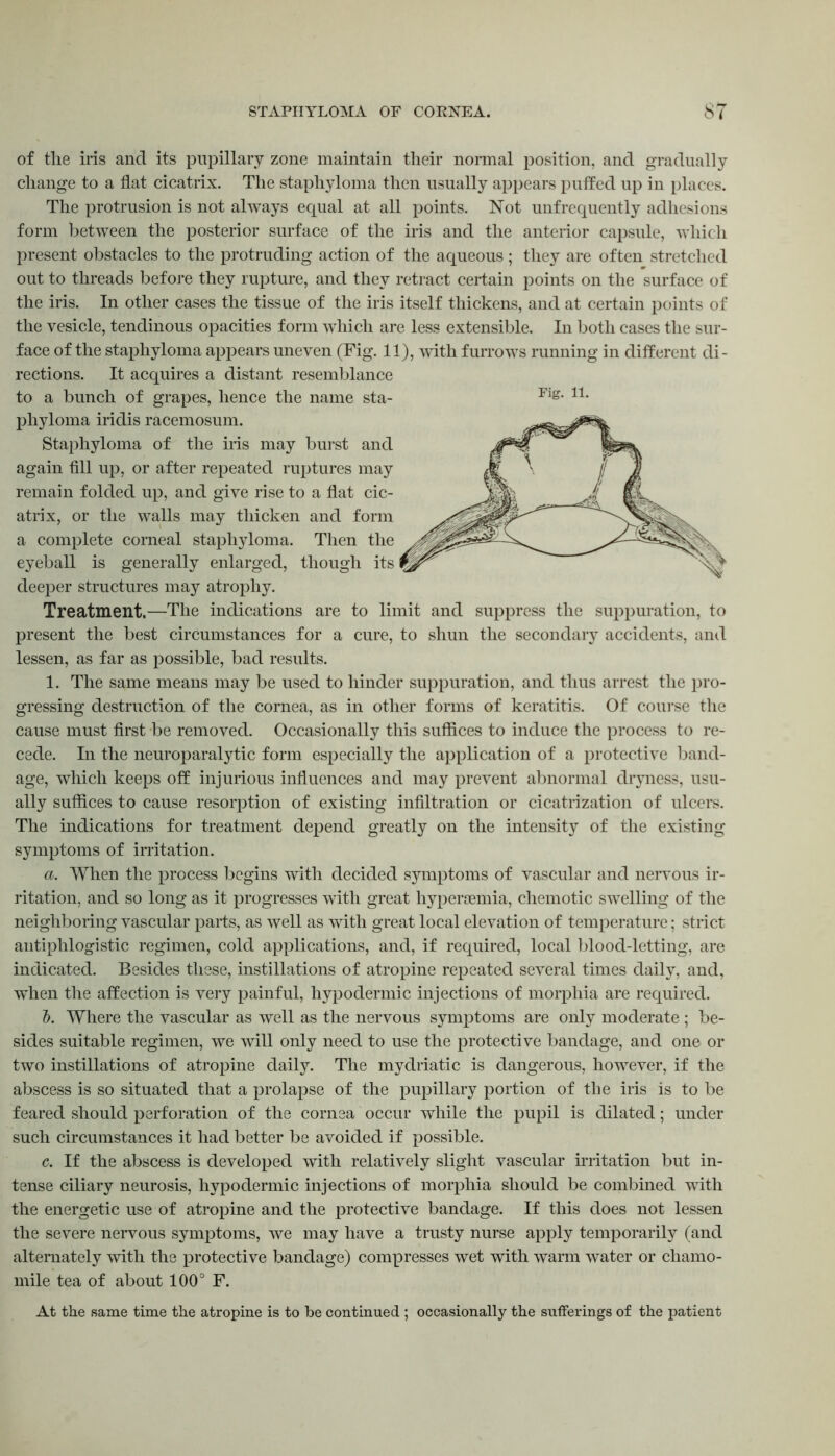 of the iris and its pupillary zone maintain their normal position, and gradually change to a flat cicatrix. The staphyloma then usually appears puffed up in places. The protrusion is not always equal at all points. Not unfrcquently adhesions form between the posterior surface of the iris and the anterior capsule, which present obstacles to the protruding action of the aqueous; they are often stretched out to threads before they rupture, and they retract certain points on the surface of the iris. In other cases the tissue of the iris itself thickens, and at certain points of the vesicle, tendinous opacities form which are less extensible. In both cases the sur- face of the staphyloma appears uneven (Fig. 11), with furrows running in different di- rections. It acquires a distant resemblance to a bunch of grapes, hence the name sta- phyloma iridis racemosum. Staphyloma of the iris may burst and again fill up, or after repeated ruptures may remain folded up, and give rise to a flat cic- atrix, or the walls may thicken and form a complete comeal staphyloma. Then the eyeball is generally enlarged, though its deeper structures may atrophy. Treatment.—The indications are to limit and suppress the suppuration, to present the best circumstances for a cure, to shun the secondary accidents, and lessen, as far as possible, bad results. 1. The same means may be used to hinder suppuration, and thus arrest the pro- gressing destruction of the cornea, as in other forms of keratitis. Of course the cause must first be removed. Occasionally this suffices to induce the process to re- cede. In the neuroparalytic form especially the application of a protective band- age, which keeps off injurious influences and may prevent abnormal dryness, usu- ally suffices to cause resorption of existing infiltration or cicatrization of ulcers. The indications for treatment depend greatly on the intensity of the existing symptoms of irritation. a. When the process begins with decided symptoms of vascular and nervous ir- ritation, and so long as it progresses with great hypersemia, chemotic swelling of the neighboring vascular parts, as well as with great local elevation of temperature; strict antiphlogistic regimen, cold applications, and, if required, local blood-letting, are indicated. Besides these, instillations of atropine repeated several times daily, and, when the affection is very painful, hypodermic injections of morphia are required. b. Where the vascular as well as the nervous symptoms are only moderate ; be- sides suitable regimen, we will only need to use the protective bandage, and one or two instillations of atropine daily. The mydriatic is dangerous, however, if the abscess is so situated that a prolapse of the pupillary portion of the iris is to be feared should perforation of the cornea occur while the pupil is dilated; under such circumstances it had better be avoided if possible. c. If the abscess is developed with relatively slight vascular irritation but in- tense ciliary neurosis, hypodermic injections of morphia should be combined with the energetic use of atropine and the protective bandage. If this does not lessen the severe nervous symptoms, we may have a trusty nurse apply temporarily (and alternately with the protective bandage) compresses wet with warm water or chamo- mile tea of about 100° F. At the same time the atropine is to be continued ; occasionally the sufferings of the patient
