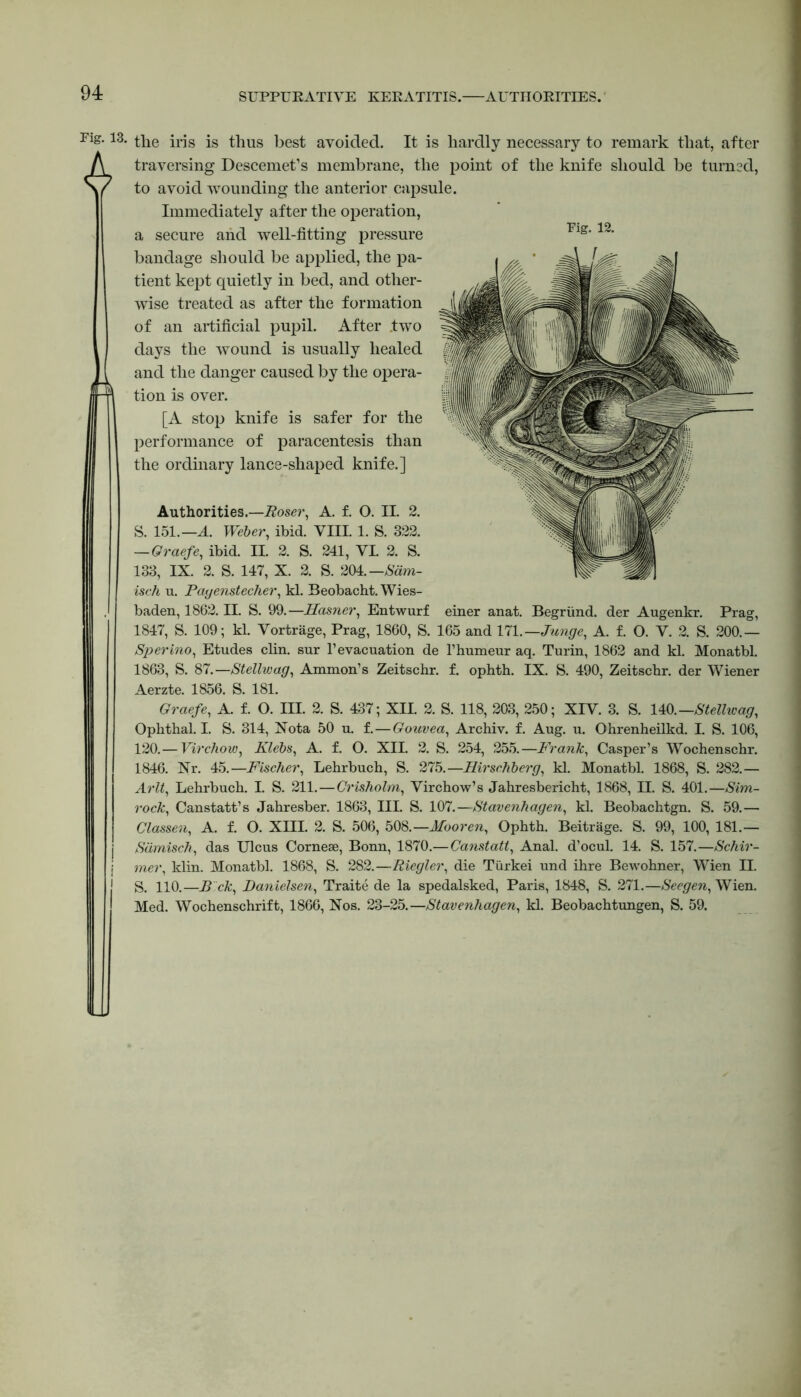 SUPPURATIVE KERATITIS. AUTHORITIES. 13. the iris is thus best avoided. It is hardly necessary to remark that, after traversing Descemet’s membrane, the point of the knife should be turned, to avoid wounding the anterior capsule. Immediately after the operation, a secure and well-fitting pressure bandage should be applied, the pa- tient kept quietly in bed, and other- wise treated as after the formation of an artificial pupil. After two days the wound is usually healed and the danger caused by the opera- tion is over. [A stop knife is safer for the performance of paracentesis than the ordinary lance-shaped knife.] Authorities.—Roser, A. f. O. II. 2. S. 151.—A. Weber, ibid. VIII. 1. S. 322. — Graefe, ibid. II. 2. S. 241, VI. 2. S. 133, IX. 2. S. 147, X. 2. S. 204.— Sdm- isch u. Payenstecher, kl. Beobacht. Wies- baden, 1862. II. S. 99.—Hamer, Entwurf einer anat. Begriind. der Augenkr. Prag, 1847, S. 109; kl. Vortrage, Prag, 1860, S. 165 and 171 .—Junge, A. f. O. V. 2. S. 200.— Sperino, Etudes clin. sur 1’evacuation de l’humeur aq. Turin, 1862 and kl. Monatbl. 1863, S. 87.—Stellwag, Ammon’s Zeitschr. f. ophth. IX. S. 490, Zeitschr. der Wiener Aerzte. 1856. S. 181. Graefe, A. f. O. III. 2. S. 437; XII. 2. S. 118, 203, 250; XIV. 3. S. 140.— Stellwag, Ophthal. I. S. 314, Not a 50 u. f.—Gouvea, Archiv. f. Aug. u. Ohrenheilkd. I. S. 106, 120.— Virchow, Klebs, A. f. O. XII. 2. S. 254, 255.—Frank, Casper’s Wochenschr. 1846. Nr. 45.—Fischer, Lehrbuch, S. 275.—Hirschberg, kl. Monatbl. 1868, S. 282.— Arlt, Lehrbuch. I. S. 211.—Crisholm, Virchow’s Jahresbericht, 1868, II. S. 401.—Sim- rock, Canstatt’s Jahresber. 1863, III. S. 107.—Stavenhagen, kl. Beobachtgn. S. 59.— Classen, A. f. O. XIII. 2. S. 506, 508.—Mooren, Ophth. Beitrage. S. 99, 100, 181.— Sdmisch, das Ulcus Cornese, Bonn, 1870.—Canstatt, Anal, d’ocul. 14. S. 157.—Schir- mer, klin. Monatbl. 1868, S. 282.—Riegler, die Tiirkei und ihre Bewohner, Wien II. S. 110.—B ck, Danielsen, Traite de la spedalsked, Paris, 1848, S. 271.—Seegen, Wien. Med. Wochenschrift, 1866, Nos. 23-25.—Stavenhagen, kl. Beobachtungen, S. 59.