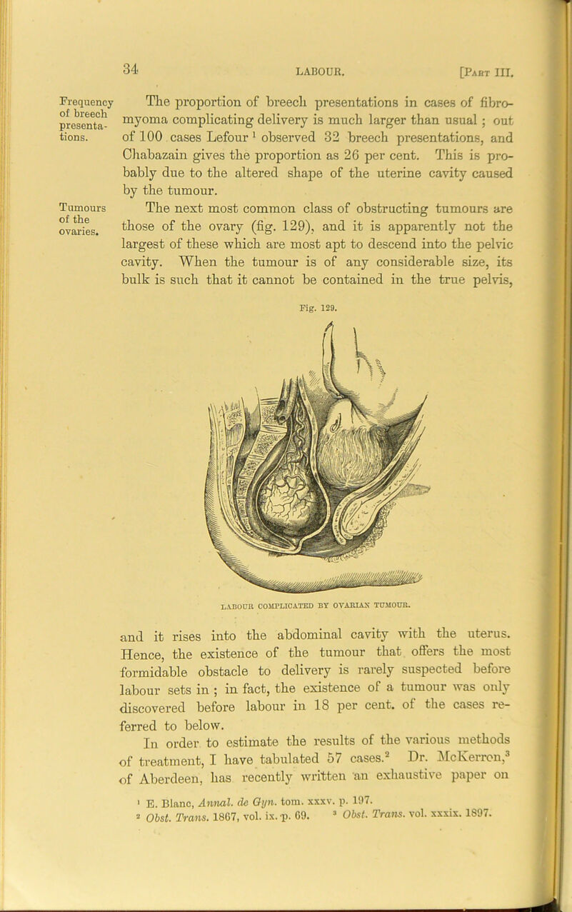Frequency of breech presenta- tions. Tumours of the ovaries. The proportion of breech presentations in cases of fibro- myoma complicating delivery is much larger than usual ; out of 100 cases Lefour 1 observed 32 breech presentations, and Chabazain gives the proportion as 26 per cent. This is pro- bably due to the altered shape of the uterine cavity caused by the tumour. The next most common class of obstructing tumours are those of the ovary (fig. 129), and it is apparently not the largest of these which are most apt to descend into the pelvic cavity. When the tumour is of any considerable size, its bulk is such that it cannot be contained in the true pelvis, Pig. 129. and it rises into the abdominal cavity with the uterus. Hence, the existence of the tumour that offers the most formidable obstacle to delivery is rarely suspected before labour sets in ; in fact, the existence of a tumour was only discovered before labour in IS per cent, ot the cases re- ferred to below. In order to estimate the results of the various methods of treatment, I have tabulated 5/ cases.2 Dr. McKerron, of Aberdeen, has recently written an exhaustive paper on 1 E. Blanc, Annal. dc Oyn. tom. xxxv. p. 197. ^ Obst. Trans. 1867, vol. ix.p. 69. 3 Obst. Traits, vol. xxxix. 1897.