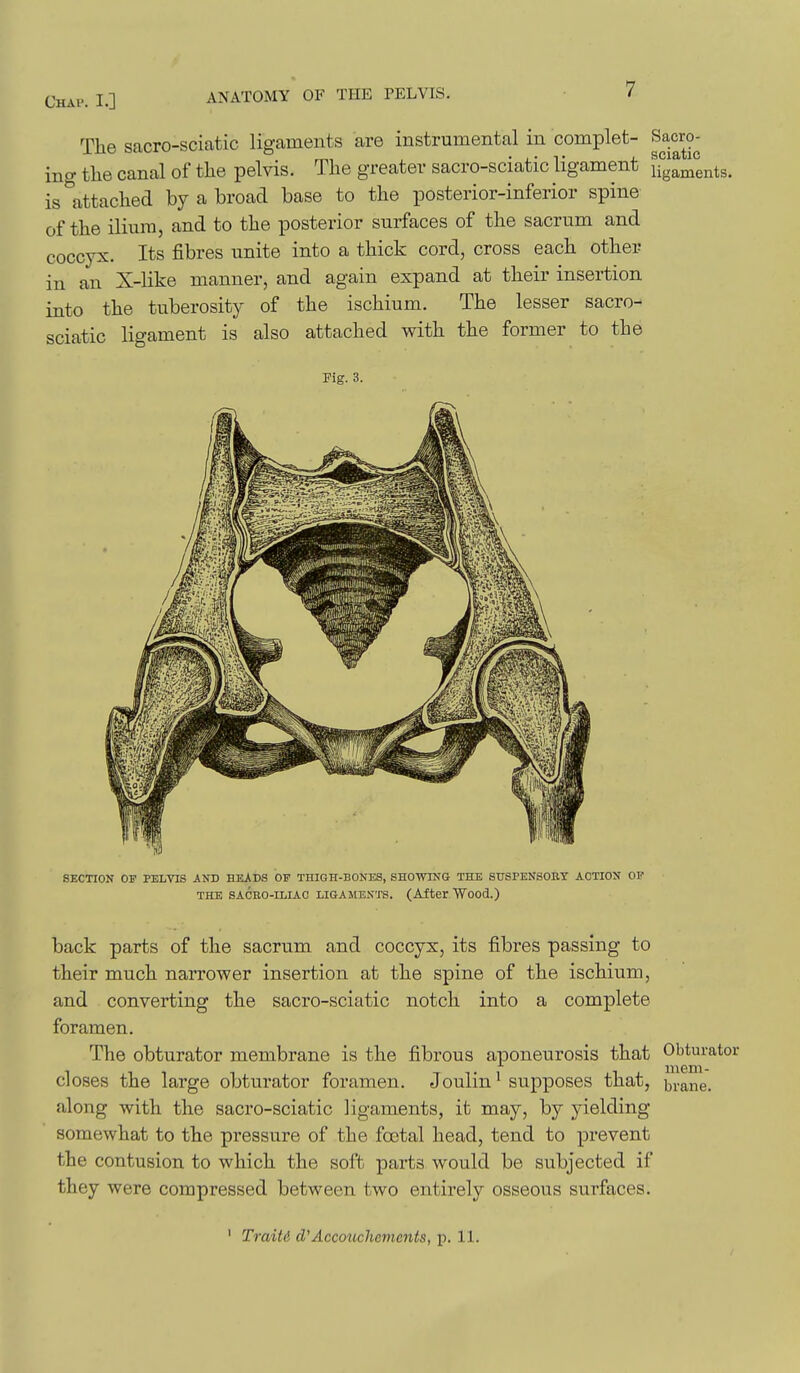 The sacro-sciatic ligaments are instrumental in complet- Sacro- ing tlie canal of the pelvis. The greater sacro-sciatic ligament ifgaments. is attached hj a broad base to the posterior-inferior spine of the ilium, and to the posterior surfaces of the sacrum and coccyx. Its fibres unite into a thick cord, cross each other in an X-like manner, and again expand at their insertion into the tuberosity of the ischium. The lesser sacro- sciatic ligament is also attached with the former to the Fig. 3. SECTION OF PELYIS AKD HEilDS OF THIGH-BONES, SHOWING THE SUSPENSORY ACTION OF THE SACHO-ILIAC LIGAMENTS. (After.Wood.) back parts of the sacrum and coccyx, its iibres passing to their much narrower insertion at the spine of the ischium, and converting the sacro-sciatic notch into a complete foramen. The obturator membrane is the fibrous aponeurosis that closes the large obturator foramen. Joulin^ supposes that, along with the sacro-sciatic ligaments, it may, by yielding somewhat to the pressure of the foetal head, tend to prevent the contusion to which the soft parts would be subjected if they were compressed between two entirely osseous surfaces. Obturator mem- brane.