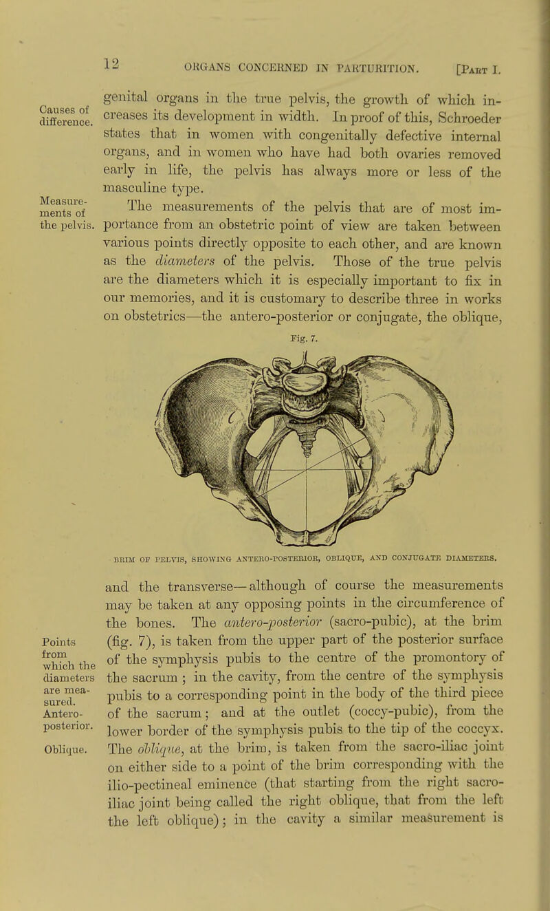 Causes of difference Measure merits of genital organs in the true pelvis, the growth of which in- creases its development in width. In proof of this, Schroeder states that in women with congenitally defective internal organs, and in women who have had both ovaries removed early in life, the pelvis has always more or less of the masculine type. The measurements of the pelvis that are of most im- the pelvis, portance from an obstetric point of view are taken between various points directly opposite to each other, and are known as the diameters of the pelvis. Those of the true pelvis are the diameters which it is especially important to fix in our memories, and it is customary to describe three in works on obstetrics—the antero-posterior or conjugate, the oblique, Fig. 7. i Points from which the diameters are mea- sured. Antero- posterior. Oblique. BRIM OF PELVJS, SHOWING AXTERO-rOSTEIllOR, OBLIQUE, AND COXJU&ATK DIAMETERS. and the transverse—although of course the measurements may be taken at any opposing points in the circumference of the bones. The antero-ioosterior (sacro-pubic), at the brim (fig. 7), is taken from the upper part of the posterior surface of the symphysis pubis to the centre of the promontory of the sacrum ; in the cavity, from the centre of the sjonphysis pubis to a corresponding point in the body of the third piece of the sacrum; and at the outlet (coccy-pubic), from the lower border of the symphysis pubis to the tip of the coccyx. The ohlique, at the brim, is taken from the sacro-iliac joint on either side to a point of the brim corresponding with the ilio-pectineal eminence (that starting from the right sacro- iliac joint being called the right oblique, that from the left the left oblique); in the cavity a similar measurement is