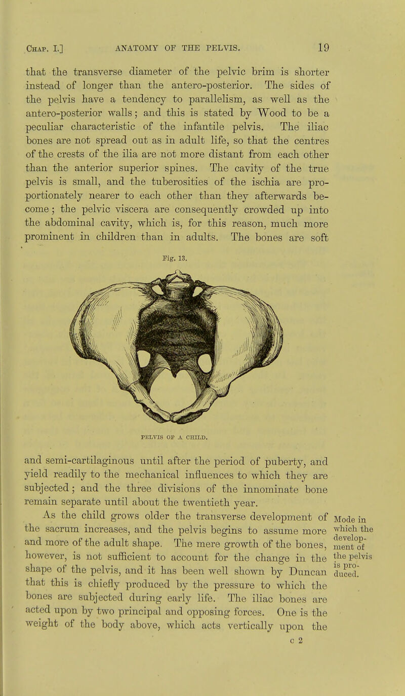 that tlie transverse diameter of the pelyic brim is shorter instead of longer than the antero-posterior. The sides of the pelvis have a tendency to parallelism, as well as the antero-posterior walls; and this is stated by Wood to be a peculiar characteristic of the infantile pelvis. The iliac bones are not spread out as in adult life, so that the centres of the crests of the ilia are not more distant from each other than the anterior superior spines. The cavity of the true pelvis is small, and the tuberosities of the ischia are pro- portionately nearer to each other than they afterwards be- come ; the pelvic viscera are consequently crowded up into the abdominal cavity, which is, for this reason, much more prominent in children than in adults. The bones are soft Pig. 13. PELVIS Off A CHILD. and semi-cartilaginous until after the period of puberty, and yield readily to the mechanical influences to which they are subjected; and the three divisions of the innominate bone remain separate until about the twentieth year. As the child grows older the transverse development of Mode in the sacrum increases, and the pelvis begins to assume more ^^1°^^ and more of the adult shape. The mere growth of the bones, mJntTf however, is not sufficient to account for the change in the the pelvis shape of the pelvis, and it has been well shown by Duncan diS. that this is chiefly produced by the pressure to which the bones are subjected during early life. The iliac bones are acted upon by two principal and opposing forces. One is the weight of the body above, which acts vertically upon the c 2