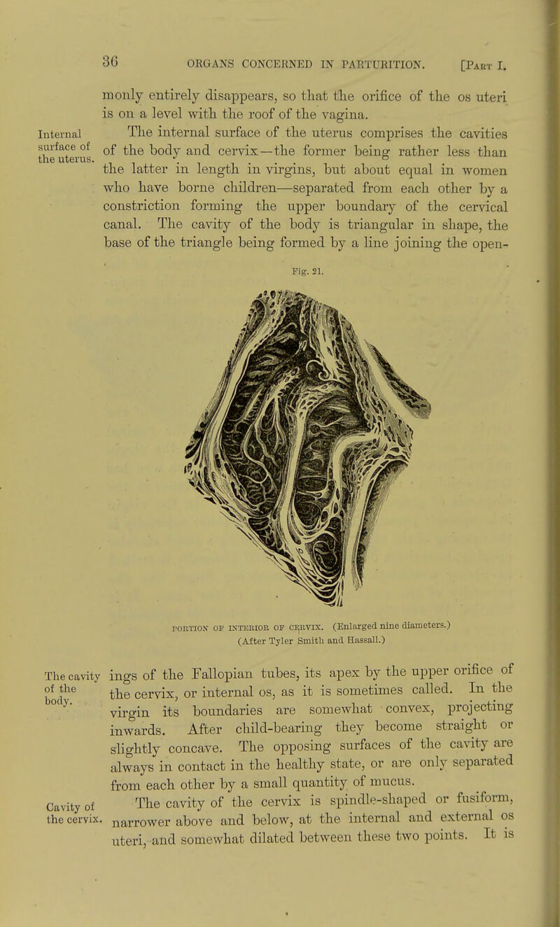 Internal surface of the uterus. monly entirely disappears, so that tlie orifice of the os uteri is on a level with the roof of the vagina. The internal surface of the uterus comprises the cavities of the body and cervix—the former being rather less than the latter in length in virgins, but about equal in women who have borne children—separated from each other by a constriction forming the upper boundary of the cervical canal. The cavity of the body is triangular in shape, the base of the triangle being formed by a line joining the open- Fig. 21. ronxiOiV of kitsbioe of ci^btix. (Enlaxged nine diameters.) (After Tyler Smitli and Hassall.) The cavity ings of the Fallopian tubes, its apex by the upper orifice of of the body the cervix, or internal os, as it is sometimes called. In the virgin its boundaries are somewhat convex, projecting inwards. After child-bearing they become straight or slightly concave. The opposing surfaces of the cavity are always in contact in the healthy state, or are only separated from each other by a small quantity of mucus. Cavity of The cavity of the cervix is spindle-shaped or fusiform, the cervix, narrower above and below, at the internal and external os uteri, and somewhat dilated between these two points. It is