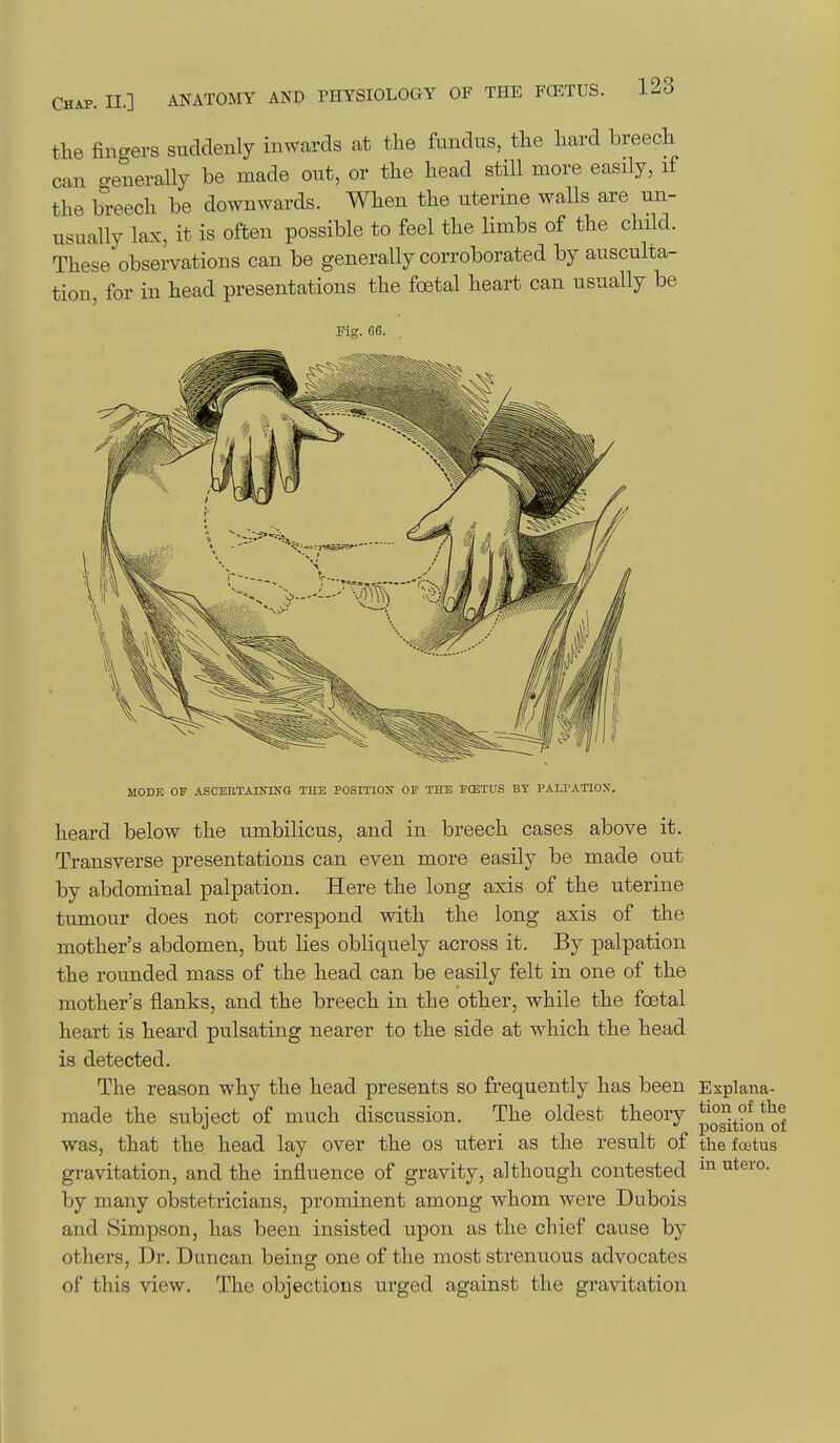 tlie fingers suddenly inwards at the fundus, the hard breech can generally be made out, or the head still more easily, if the breech be downwards. When the uterine walls are un- usually lax, it is often possible to feel the limbs of the child. These observations can be generally corroborated by ausculta- tion, for in head presentations the foetal heart can usually be Fig. 66. MODE OF ASCEBTAINING THE POSITION OF THE FCETUS BY PALPATIOX. heard below the umbilicus, and in breech cases above it. Transverse presentations can even more easily be made out by abdominal palpation. Here the long axis of the uterine tumour does not correspond with the long axis of the mother's abdomen, but lies obliquely across it. By palpation the rounded mass of the head can be easily felt in one of the mother's flanks, and the breech in the other, while the foetal heart is heard pulsating nearer to the side at which the head is detected. The reason why the head presents so frequently has been Explana- made the subject of much discussion. The oldest theory p°5t°oj*Qf was, that the head lay over the os uteri as the result of the fcstus gravitation, and the influence of gravity, although contested by many obstetricians, prominent among whom were Dubois and Simpson, has been insisted upon as the chief cause by others, Dr. Duncan being one of the most strenuous advocates of this view. The objections urged against the gravitation