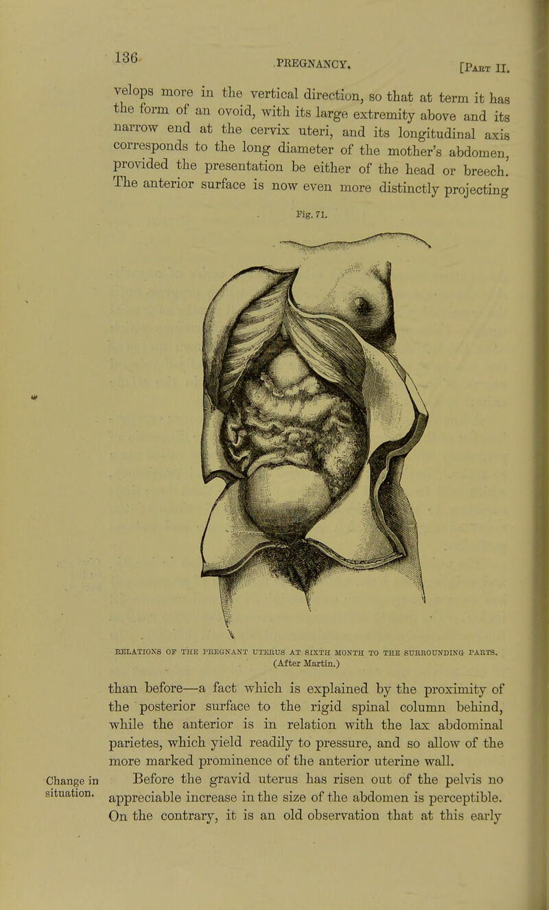 PREGNANCY. [Paet II. Change in situation. velops more in the vertical direction, so that at term it has the form of an ovoid, with its large extremity above and its narrow end at the cervix uteri, and its longitudinal axis corresponds to the long diameter of the mother's abdomen, provided the presentation be either of the head or breech! The anterior surface is now even more distinctly projecting Mg. 71. BBLATIOXS OP THE PllEGNANT UTERUS AT SIXTH MONTH TO THE SURBOUNDINO PAET3. (After Martin.) than before—a fact which is explained by the proximity of the posterior surface to the rigid spinal column behind, while the anterior is in relation with the lax abdominal parietes, which yield readily to pressure, and so allow of the more marked prominence of the anterior uterine wall. Before the gravid uterus has risen out of the pelvis no appreciable increase in the size of the abdomen is perceptible. On the contrary, it is an old observation that at this early
