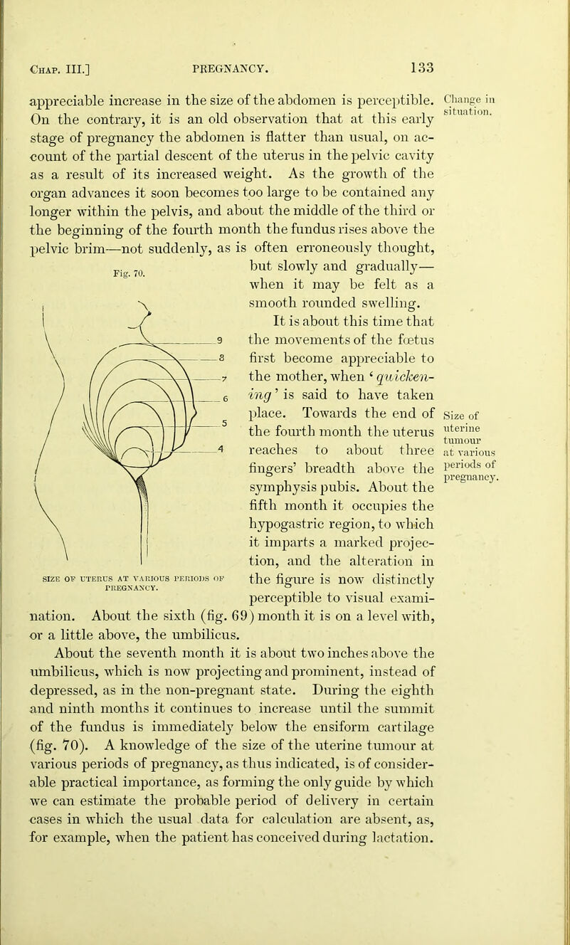 appreciable increase in the size of the abdomen is perceptible. On the contrary, it is an old observation that at this early stage of pregnancy the abdomen is flatter than usual, on ac- count of the partial descent of the uterus in the pelvic cavity as a result of its increased weight. As the growth of the organ advances it soon becomes too large to be contained any longer within the pelvis, and about the middle of the third or the beginning of the fourth month the fundus rises above the pelvic brim—not suddenly, as is often erroneously thought, but slowly and gradually— when it may be felt as a smooth rounded swelling. It is about this time that the movements of the foetus first become appreciable to the mother,when ‘quicken- ing ’ is said to have taken place. Towards the end of the fourth month the uterus reaches to about three fingers’ breadth above the symphysis pubis. About the fifth month it occupies the hypogastric region, to which it imparts a marked projec- tion, and the alteration in the figure is now distinctly perceptible to visual exami- nation. About the sixth (fig. G9) month it is on a level with, or a little above, the umbilicus. About the seventh month it is about two inches above the umbilicus, which is now projecting and prominent, instead of depressed, as in the non-pregnant state. During the eighth and ninth months it continues to increase until the summit of the fundus is immediatel}7 below the ensiform cartilage (fig. 70). A knowledge of the size of the uterine tumour at various periods of pregnancy, as thus indicated, is of consider- able practical importance, as forming the only guide by which we can estimate the probable period of delivery in certain cases in which the usual data for calculation are absent, as, for example, when the patient has conceived during lactation. Fig. 70. PREGNANCY. Change in situation. Size of uterine tumour at various periods of pregnancy.