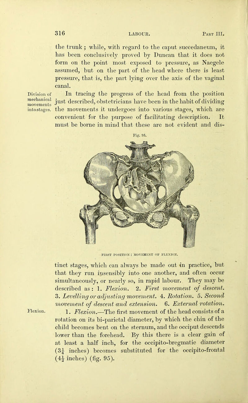 Division of mechanical movements into stages. Flexion. the trunk ; while, with regard to the caput succedaneum, it has been conclusively proved by Duncan that it does not form on the point most exposed to pressure, as Naegele assumed, but on the part of the head where there is least pressure, that is, the part lying over the axis of the vaginal canal. In tracing the progress of the head from the position just described, obstetricians have been in the habit of dividing the movements it undergoes into various stages, which are convenient for the purpose of facilitating description. It must be borne in mind that these are not evident and dis- Fig. 95. FIRST POSITION : MOVEMENT OF FLEXION. tinct stages, which can always be made out in practice, but that they run insensibly into one another, and often occur simultaneously, or nearly so, in rapid labour. They may be described as: 1. Flexion. 2. First movement of descent. 3. Levelling or adjusting movement. 4. Rotation. 5. Second movement of descent and extension. 6. External rotation. 1. Flexion.—The first movement of the head consists of a rotation on its bi-parietal diameter, by which the chin of the child becomes bent on the sternum, and the occiput descends lower than the forehead. By this there is a clear gain of at least a half inch, for the occipito-bregmatic diameter (3j- inches) becomes substituted for the occipito-frontal (44 inches) (fig. 95).