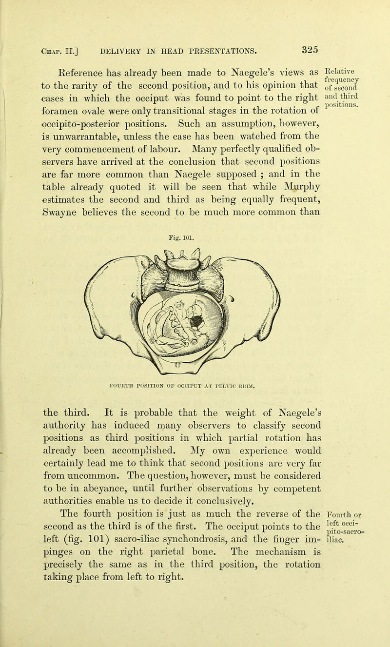 Reference has already been made to Naegele’s views as to the rarity of the second position, and to his opinion that cases in which the occiput was found to point to the right foramen ovale were only transitional stages in the rotation of occipito-posterior positions. Such an assumption, however, is unwarrantable, unless the case has been watched from the very commencement of labour. Many perfectly qualified ob- servers have arrived at the conclusion that second positions are far more common than Naegele supposed ; and in the table already quoted it will be seen that while Murphy estimates the second and third as being equally frequent, Swayne believes the second to be much more common than Fig. 101. the third. It is probable that the weight of Naegele’s authority has induced many observers to classify second positions as third positions in which partial rotation has already been accomplished. My own experience would certainly lead me to think that second positions are very far from uncommon. The question, however, must be considered to be in abeyance, until further observations by competent authorities enable us to decide it conclusively. The fourth position is just as much the reverse of the second as the third is of the first. The occiput points to the left (fig. 101) sacro-iliac synchondrosis, and the finger im- pinges on the right parietal bone. The mechanism is precisely the same as in the third position, the rotation taking place from left to right. Relative frequency of second and third positions. Fourth oi- left occi- pito-sacro- iliac.