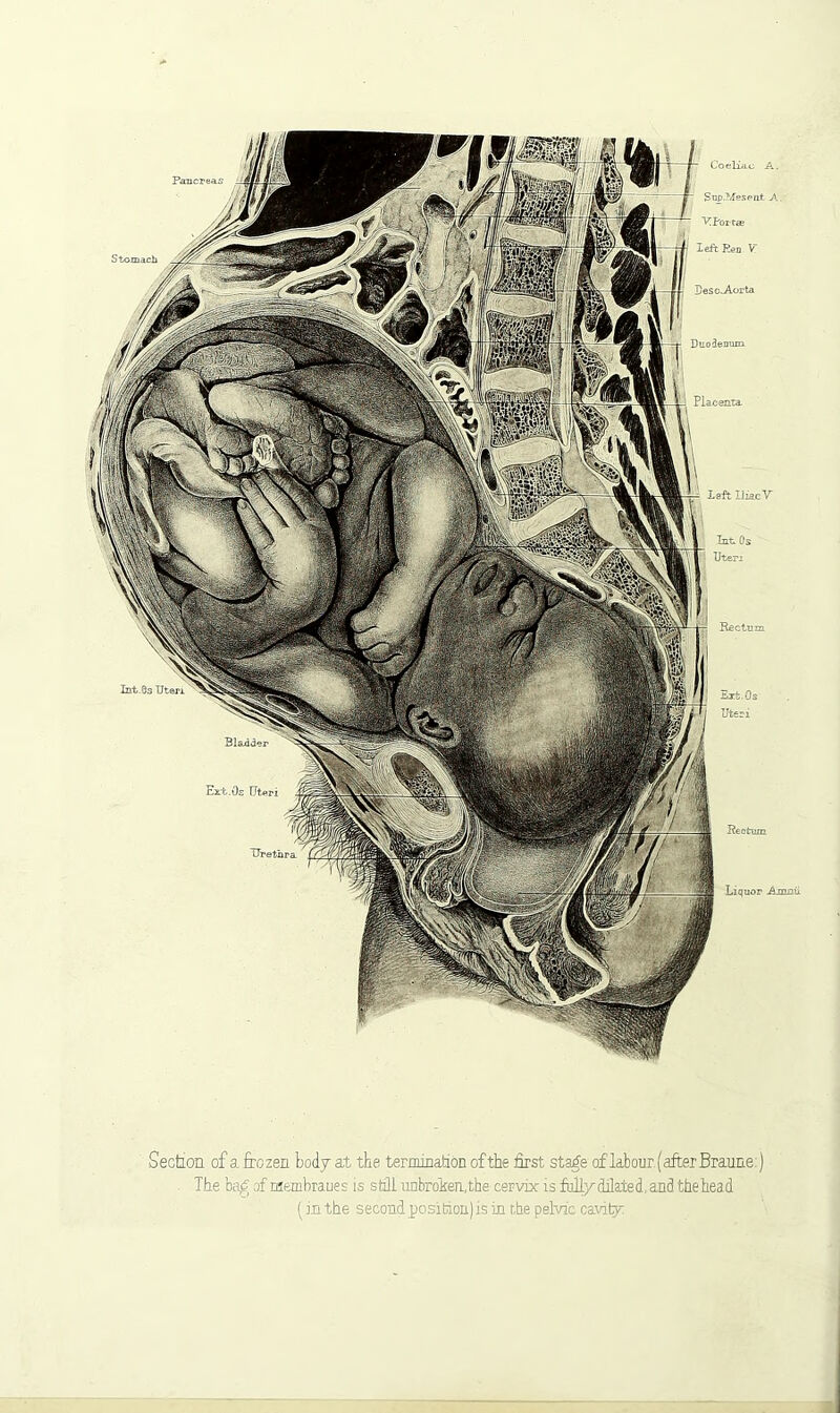 Coeliac A. Sup.Mesent A. Desc^Aorta Duodenum Placenta. Left Iliac V Int Os Int.Os Uteri Bladd' Rectum Section of a frozen body at the termination of the first sta^e of labour (after Braune) The ba,tf of membranes is still unbroken,the cervix is fully dilated, and the head (in the second position) is in the pelvic cavity