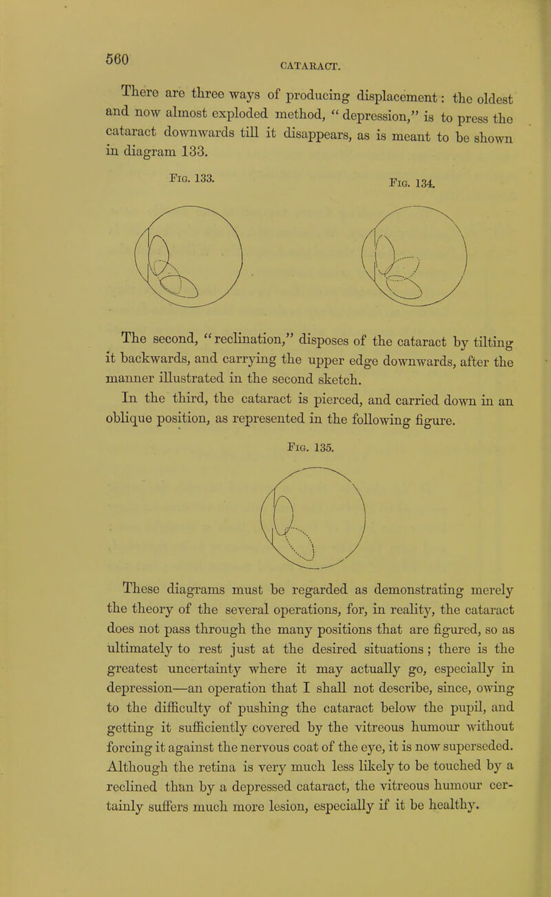 CATARACT. There are three ways of producing displacement: the oldest and now almost exploded method, “ depression,” is to press the cataract downwards tiU it disappears, as is meant to be shown in diagram 133. Fig. 133. The second, “ reclination,” disposes of the cataract by tilting it backwards, and carrjdng the upper edge downwards, after the manner illustrated in the second sketch. In the third, the cataract is pierced, and carried down in an oblique position, as represented in the following figure. Fig. 135. These diagrams must be regarded as demonstrating merely the theory of the several operations, for, in reality, the cataract does not pass through the many positions that are figm-ed, so as ultimately to rest just at the desired situations; there is the greatest uncertainty where it may actually go, especially in depression—an operation that I shall not describe, since, owing to the difficulty of pushing the cataract below the pupil, and getting it sufficiently covered by the vitreous humour without forcing it against the nervous coat of the eye, it is now superseded. Although the retina is very much less likely to be touched by a reclined than by a depressed cataract, the vitreous humour cer- tainly suffers much more lesion, especially if it be healthy.