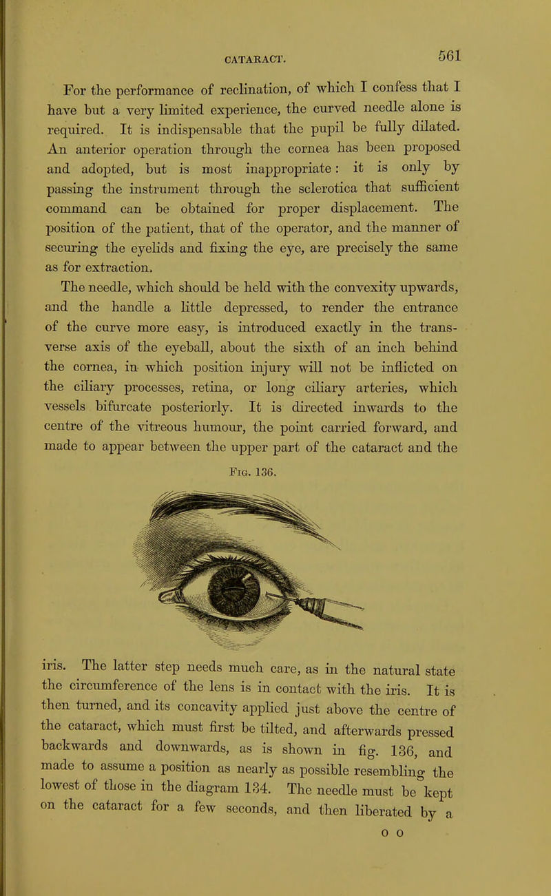 For the performance of reclination, of which I confess that I have hut a very limited experience, the curved needle alone is required. It is indispensable that the pupil be fully dilated. An anterior operation through the cornea has been proposed and adopted, but is most inappropriate: it is only by passing the instrument through the sclerotica that sufficient command can be obtained for proper displacement. The position of the patient, that of the operator, and the manner of securing the eyelids and fixing the eye, are precisely the same as for extraction. The needle, which should be held with the convexity upwards, and the handle a Kttle depressed, to render the entrance of the curve more easy, is introduced exactly in the trans- verse axis of the eyeball, about the sixth of an inch behind the cornea, in which position injury will not be inflicted on the ciliary processes, retina, or long ciliary arteries, which vessels bifurcate posteriorly. It is directed inwards to the centre of the vitreous humour, the point carried forward, and made to appear between the upper part of the cataract and the Fig. 136. iris. The latter step needs much care, as in the natural state the circumference of the lens is in contact with the iris. It is then turned, and its concavity applied just above the centre of the cataract, which must first be tilted, and afterwards pressed backwards and downwards, as is shown in fig. 136, and made to assume a position as nearly as possible resembling the lowest of those in the diagram 134. The needle must be kept on the cataract for a few seconds, and then liberated by a o o