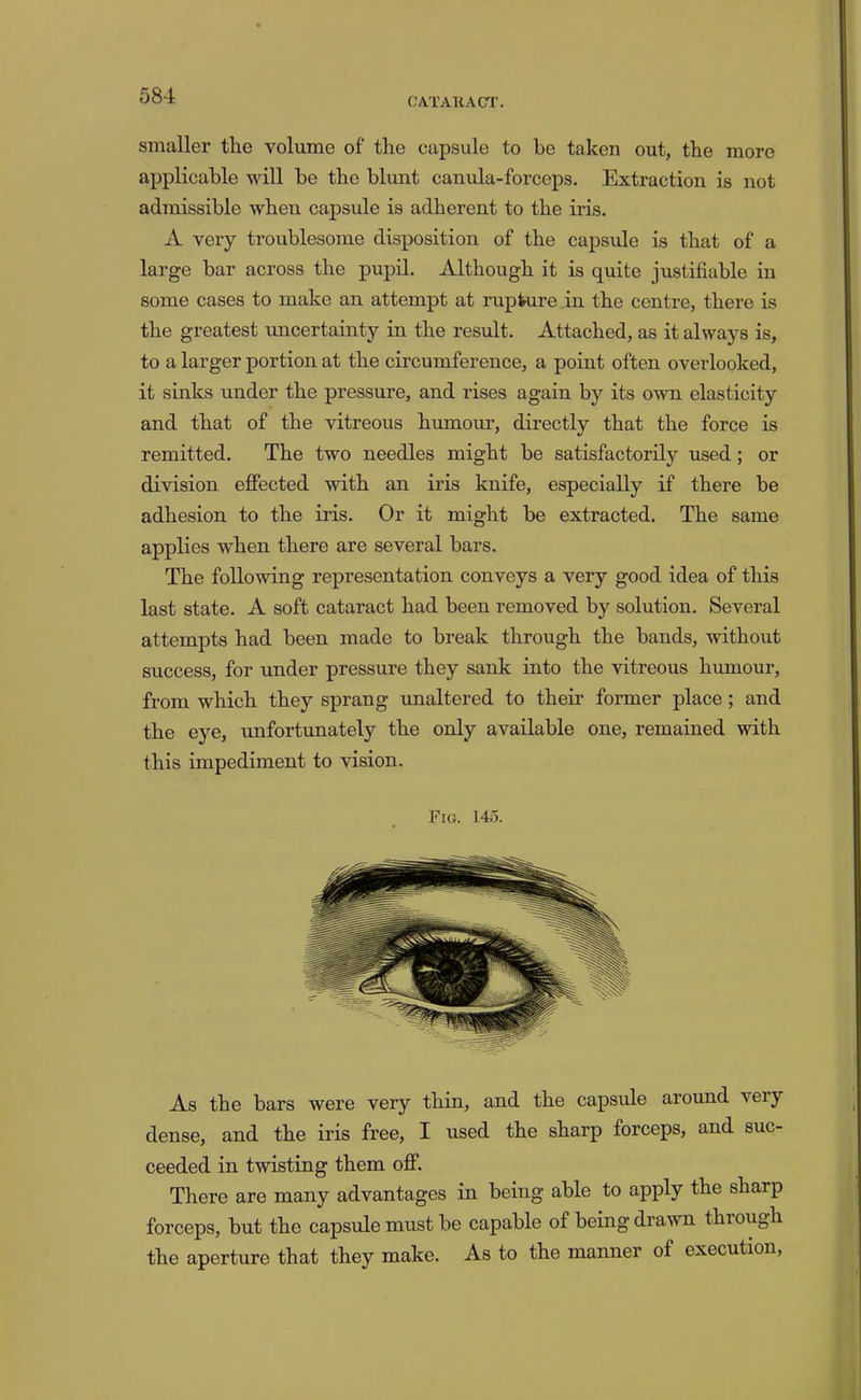 C/VTAKACT. smaller the volume of the capsule to he taken out, the more applicable will be the blunt canula-forceps. Extraction is not admissible when capsule is adherent to the iris. A very troublesome disposition of the capsule is that of a large bar across the pupil. Although it is quite justifiable in some cases to make an attempt at rupture in the centre, there is the greatest micertainty in the result. Attached, as it always is, to a larger portion at the circumference, a point often overlooked, it sinks under the pressure, and rises again by its own elasticity and that of the vitreous humour, directly that the force is remitted. The two needles might be satisfactorily used; or division effected with an iris knife, especially if there be adhesion to the iris. Or it might be extracted. The same applies when there are several bars. The following representation conveys a very good idea of this last state. A soft cataract had been removed by solution. Several attempts had been made to break through the bands, without success, for under pressure they sank into the vitreous humour, from which they sprang unaltered to their former place; and the eye, unfortunately the only available one, remained with this impediment to vision. Fig. 14o. As the bars were very thin, and the capsule around very dense, and the iris free, I used the sharp forceps, and suc- ceeded in twisting them off. There are many advantages in being able to apply the sharp forceps, but the capsule must be capable of being drawn through the aperture that they make. As to the manner of execution.