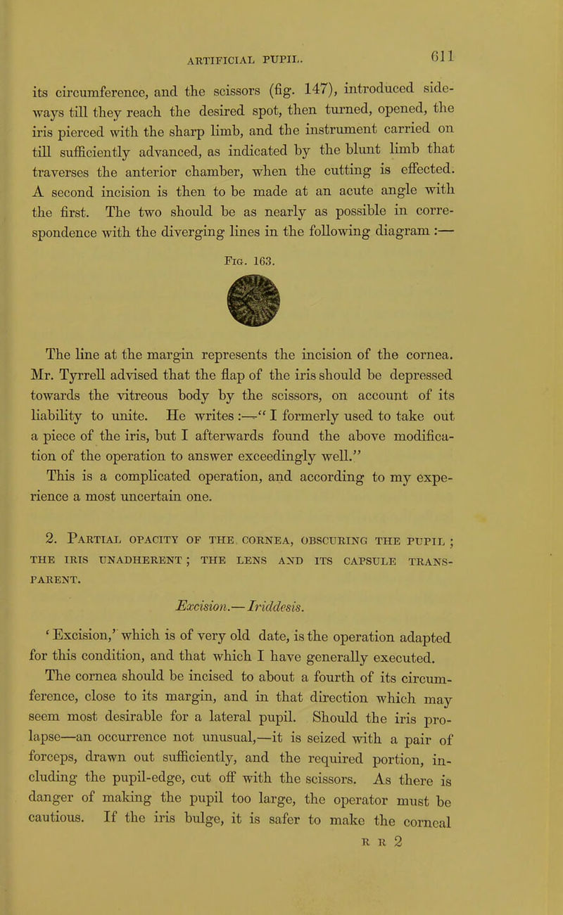 Oil its circumference, and the scissors (fig. 14/), introduced side- ways till they reach the desired spot, then turned, opened, the iris pierced with the sharp limb, and the instrument carried on till sufilciently advanced, as indicated by the blunt limb that traverses the anterior chamber, when the cutting is effected. A second incision is then to be made at an acute angle with the first. The two should be as nearly as possible in corre- spondence with the diverging lines in the following diagram :— Fig. 163. The line at the margin represents the incision of the cornea. Mr. Tyrrell advised that the flap of the iris should be depressed towards the Autreous body by the scissors, on account of its liability to unite. He writes I formerly used to take out a piece of the iris, but I afterwards found the above modifica- tion of the operation to answer exceedingly well.” This is a complicated operation, and according to my expe- rience a most uncertain one. 2. Partial opacity of the cornea, obscuring the pupil ; THE IRIS UNADHERENT ; THE LENS AND ITS CAPSULE TRANS- PARENT. Excision.—Iriddesis. ‘ Excision,’ which is of very old date, is the operation adapted for this condition, and that which I have generally executed. The cornea should be incised to about a fourth of its circum- ference, close to its margin, and in that direction which may seem most desirable for a lateral pupil. Should the iris pro- lapse—an occurrence not unusual,—it is seized with a pair of forceps, drawn out sufficiently, and the required portion, in- cluding the pupil-edge, cut off with the scissors. As there is danger of making the pupil too large, the operator must be cautious. If the iris bulge, it is safer to make the corneal