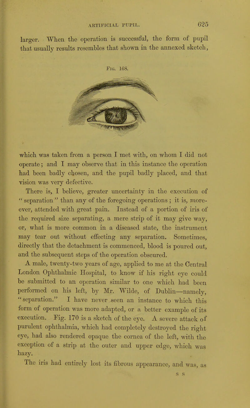 larger. When the operation is successful, the form of pupil that usually results resembles that shown in the annexed sketch, Fig. 168. which was taken from a person I met with, on whom I did not operate; and I may observe that in this instance the operation had been badly chosen, and the pupil badly placed, and that vision was very defective. There is, I believe, greater uncertainty in the execution of “ separation ” than any of the foregoing operations ; it is, more- over, attended with great pain. Instead of a portion of iris of the required size separating, a mere strip of it may give way, or, what is more common in a diseased state, the instrument may tear out without effecting any separation. Sometimes, directly that the detachment is commenced, blood is poured out, and the subsequent steps of the operation obscured. A male, twenty-two years of age, applied to me at the Central London Ophthalmic Hospital, to know if his right eye could be submitted to an operation similar to one which had been perfonned on his left, by Mr. Wilde, of Dublin—namely, “separation.” I have never seen an instance to which this form of operation was more adapted, or a better example of its execution. Fig. 170 is a sketch of the eye. A severe attack of purulent ophthalmia, which had completely destroyed the right eye, had also rendered opaque the cornea of the left, with the exception of a strip at the outer and upper edge, which was hazy. The iris had entirely lost its fibrous appearance, and was, as