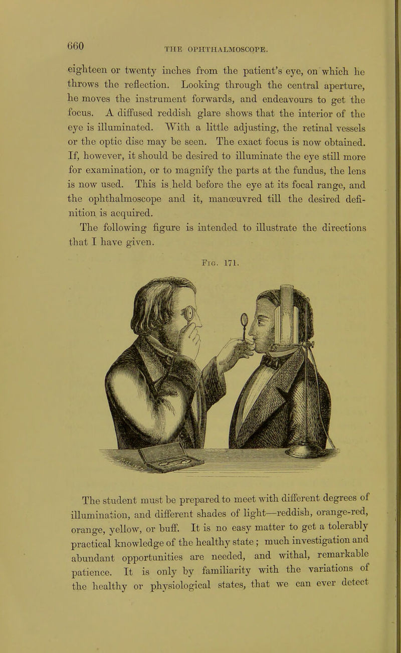 (j()0 THE OPHTHALMOSCOPE. eighteen or twenty inches from the patient’s eye, on which ho throws the reflection. Looking through the central aperture, he moves the instrument forwards, and endeavours to get the focus. A diffused reddish glare shows that the interior of the eye is illuminated. With a little adjusting, the retinal vessels or the optic disc may be seen. The exact focus is now obtained. If, however, it should be desired to illuminate the eye still more for examination, or to magnify the parts at the fundus, the lens is now used. This is held before the eye at its focal range, and the ophthalmoscope and it, manoeuvred till the desired defl- nition is acquired. The following figure is intended to illustrate the directions that I have given. Fig. 171. The student must be prepared to meet with difierent degrees of illumination, and difierent shades of light reddish, orange-red, orange, yellow, or buff. It is no easy matter to get a toleiably practical knowledge of the healthy state; much investigation and abundant opportunities are needed, and withal, remarkable patience. It is only by familiarity with the variations of the healthy or physiological states, that we can ever detect