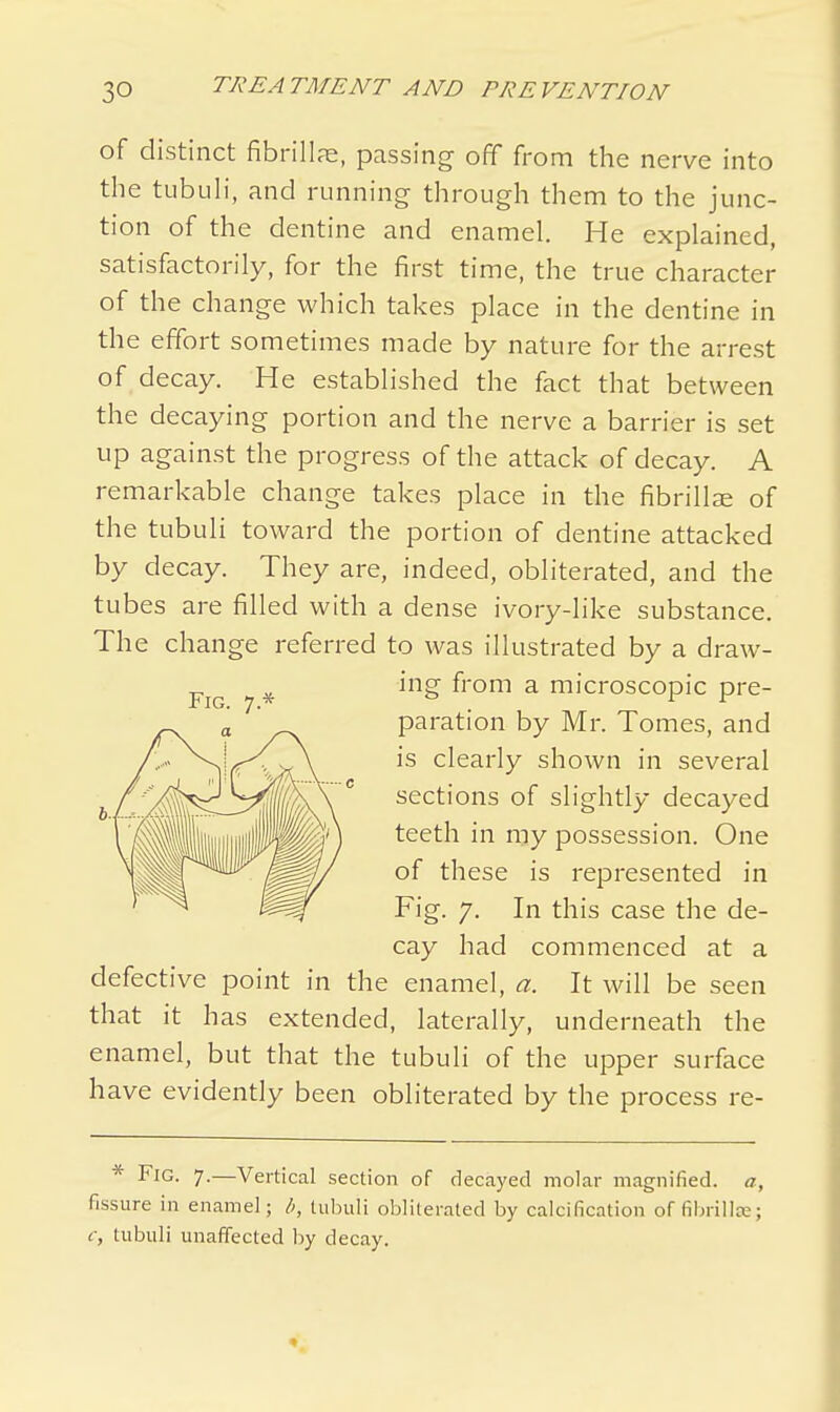 of distinct fibrillar, passing off from the nerve into the tubuli, and running through them to the junc- tion of the dentine and enamel. He explained, satisfactorily, for the first time, the true character of the change which takes place in the dentine in the effort sometimes made by nature for the arrest of decay. He established the fact that between the decaying portion and the nerve a barrier is set up against the progress of the attack of decay. A remarkable change takes place in the fibrillae of the tubuli toward the portion of dentine attacked by decay. They are, indeed, obliterated, and the tubes are filled with a dense ivory-like substance. The change referred to was illustrated by a draw- ing from a microscopic pre- paration by Mr. Tomes, and is clearly shown in several sections of slightly decayed teeth in my possession. One of these is represented in Fig. 7. In this case the de- cay had commenced at a defective point in the enamel, a. It will be seen that it has extended, laterally, underneath the enamel, but that the tubuli of the upper surface have evidently been obliterated by the process re- * Fig. 7.—Vertical section of decayed molar magnified, a, fissure in enamel; b, tubuli obliterated by calcification of fibrillse; c, tubuli unaffected by decay.