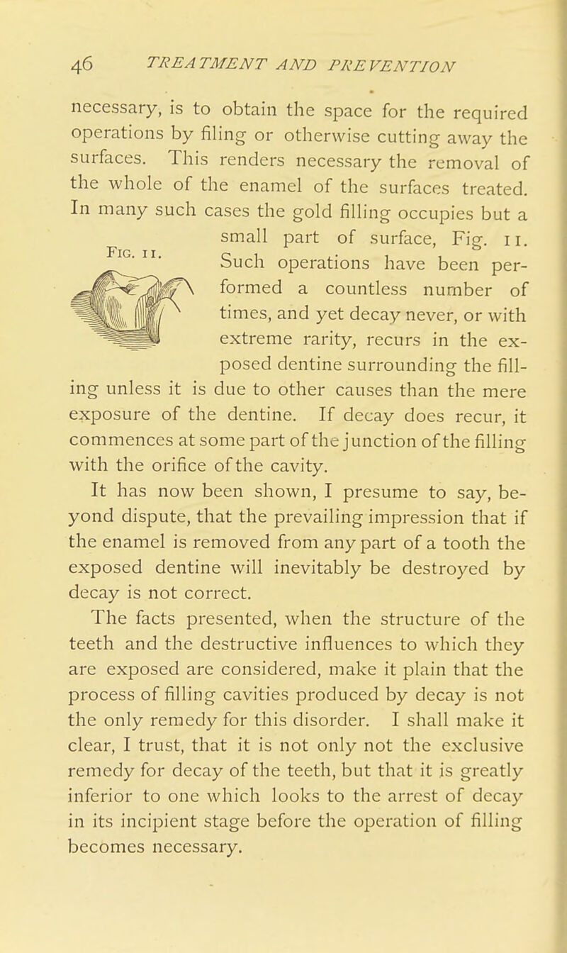 necessary, is to obtain the space for the required operations by filing or otherwise cutting away the surfaces. This renders necessary the removal of the whole of the enamel of the surfaces treated. In many such cases the gold filling occupies but a small part of surface, Fig. n. Such operations have been per- formed a countless number of times, and yet decay never, or with extreme rarity, recurs in the ex- posed dentine surrounding the fill- ing unless it is due to other causes than the mere exposure of the dentine. If decay does recur, it commences at some part of the junction of the filling with the orifice of the cavity. It has now been shown, I presume to say, be- yond dispute, that the prevailing impression that if the enamel is removed from any part of a tooth the exposed dentine will inevitably be destroyed by decay is not correct. The facts presented, when the structure of the teeth and the destructive influences to which they are exposed are considered, make it plain that the process of filling cavities produced by decay is not the only remedy for this disorder. I shall make it clear, I trust, that it is not only not the exclusive remedy for decay of the teeth, but that it is greatly inferior to one which looks to the arrest of decay in its incipient stage before the operation of filling becomes necessary.