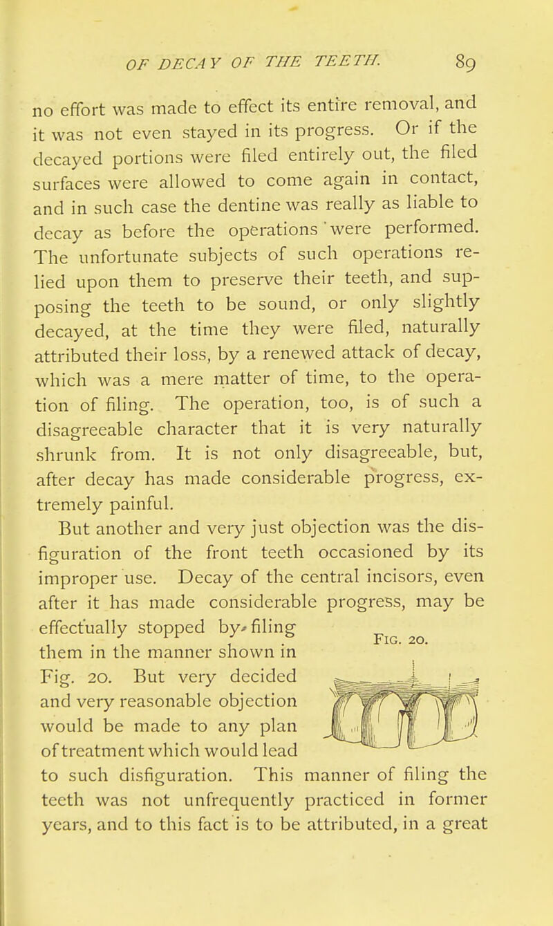 no effort was made to effect its entire removal, and it was not even stayed in its progress. Or if the decayed portions were filed entirely out, the filed surfaces were allowed to come again in contact, and in such case the dentine was really as liable to decay as before the operations'were performed. The unfortunate subjects of such operations re- lied upon them to preserve their teeth, and sup- posing the teeth to be sound, or only slightly decayed, at the time they were filed, naturally attributed their loss, by a renewed attack of decay, which was a mere matter of time, to the opera- tion of filing. The operation, too, is of such a disagreeable character that it is very naturally shrunk from. It is not only disagreeable, but, after decay has made considerable progress, ex- tremely painful. But another and very just objection was the dis- figuration of the front teeth occasioned by its improper use. Decay of the central incisors, even after it has made considerable progress, may be effectually stopped by* filing , L r . Fig. 20. them in the manner shown in Fig. 20. But very decided and very reasonable objection would be made to any plan of treatment which would lead to such disfiguration. This manner of filing the teeth was not unfrequently practiced in former years, and to this fact is to be attributed, in a great