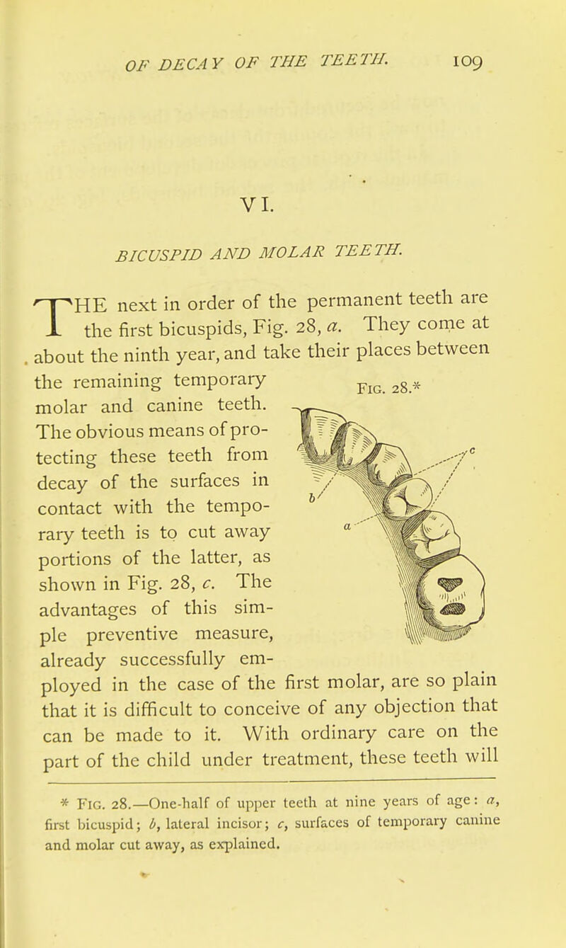 VI. BICUSPID AND MOLAR TEETH. THE next in order of the permanent teeth are the first bicuspids, Fig. 28, a. They come at . about the ninth year, and take their places between the remaining temporary molar and canine teeth. The obvious means of pro- tecting these teeth from decay of the surfaces in contact with the tempo- rary teeth is to cut away portions of the latter, as shown in Fig. 28, c. The advantages of this sim- ple preventive measure, already successfully em- ployed in the case of the first molar, are so plain that it is difficult to conceive of any objection that can be made to it. With ordinary care on the part of the child under treatment, these teeth will * Fig. 28.—One-half of upper teeth at nine years of age: a, first bicuspid; b, lateral incisor; c, surfaces of temporary canine and molar cut away, as explained.