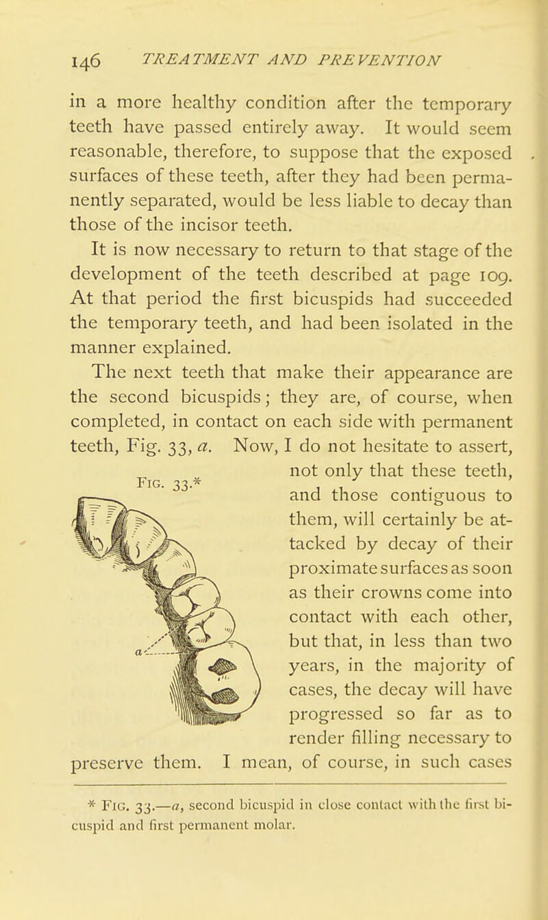 in a more healthy condition after the temporary teeth have passed entirely away. It would seem reasonable, therefore, to suppose that the exposed surfaces of these teeth, after they had been perma- nently separated, would be less liable to decay than those of the incisor teeth. It is now necessary to return to that stage of the development of the teeth described at page 109. At that period the first bicuspids had succeeded the temporary teeth, and had been isolated in the manner explained. The next teeth that make their appearance are the second bicuspids; they are, of course, when completed, in contact on each side with permanent teeth, Fig. 33, a. Now, I do not hesitate to assert, not only that these teeth, and those contiguous to them, will certainly be at- ^Jit') tacked by decay of their ri^«§» ' proximate surfaces as soon as their crowns come into contact with each other, but that, in less than two I ^» \ years, in the majority of cases, the decay will have progressed so far as to render filling necessary to preserve them. I mean, of course, in such cases * Fig. 33.—a, second bicuspid in close contact with the first bi- cuspid and first permanent molar.