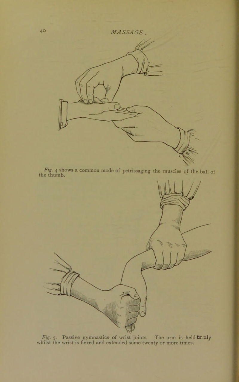 Fi>. 4 shows a common mode of petrissaging the muscles of the ball of the thumb.