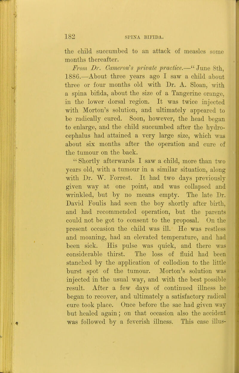 the child succumbed to an attack of measles some months thereafter. From Dr. Cameron''s private practice.— June 8th, 1886.—About three years ago I saw a child about three or four months old with Dr. A. Sloan, with a spina bifida, about the size of a Tangerine orange, in the lower dorsal region. It was twice injected with Morton's solution, and ultimately appeared to be radically cured. Soon, however, the head began to enlarge, and the child succumbed after the hydro- cephalus had attained a very large size, which was about six months after the operation and cure of the tumour on the back.  Shortly afterwards I saw a child, more than two years old, with a tumour in a similar situation, along with Dr. W. Forrest. It had two days previously given way at one point, and was collapsed and wrinkled, but by no means empty. The late Dr. David Foulis had seen the boy shortly after birth, and had recommended operation, but the parents could not be got to consent to the proposal. On the present occasion the child was ill. He was restless and moaning, had an elevated temperature, and had been sick. His pulse was quick, and there was considerable thirst. The loss of fluid had been stanched by the application of collodion to the little burst spot of the tumour. Morton's solution was injected in the usual way, and with the best possible result. After a few days of continued illness he began to recover, and ultimately a satisfactory radical cure took place. Once before the sac had given way but healed again; on that occasion also the accident was followed by a feverish illness. This case illus-