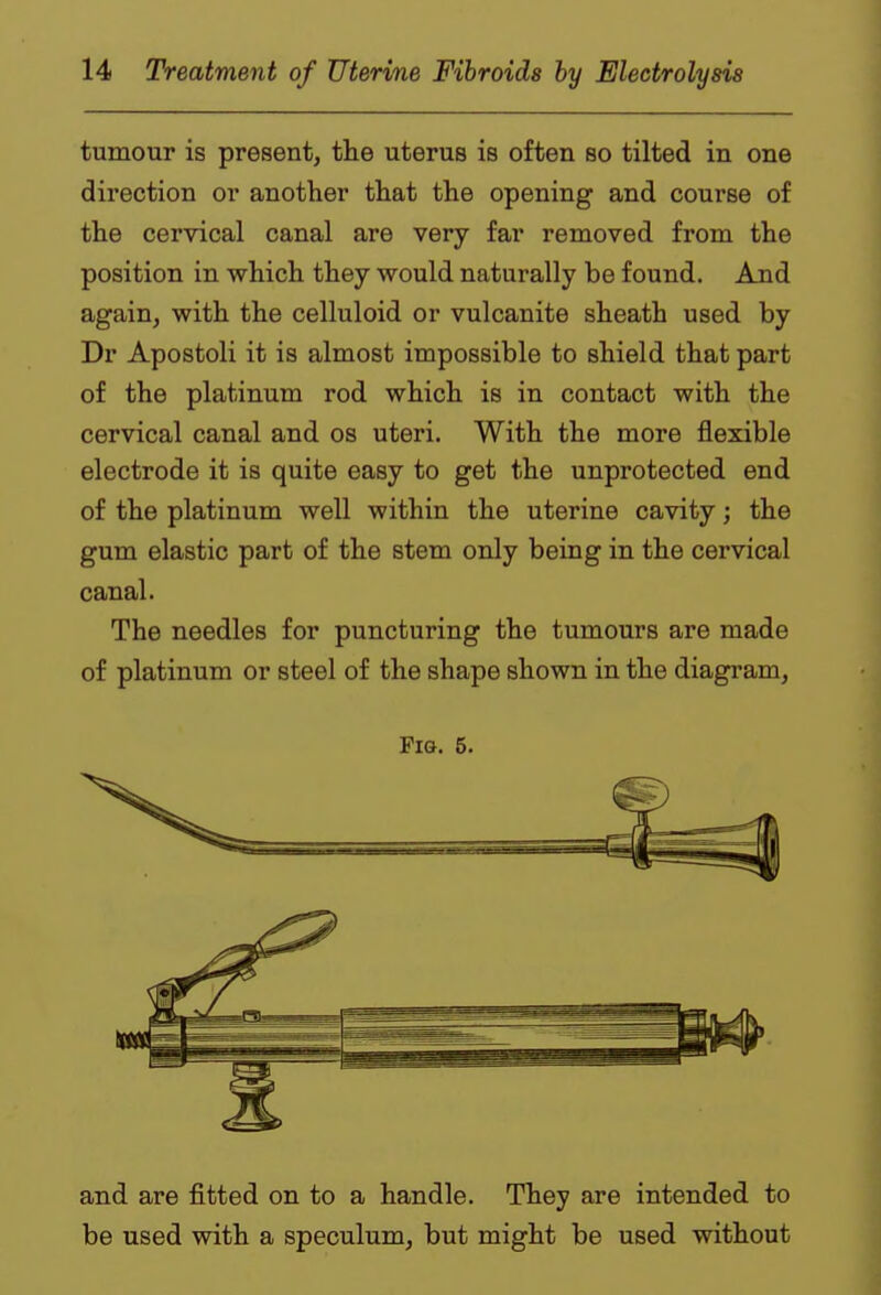 tumour is present, the uterus is often so tilted in one direction or another that the opening and course of the cervical canal are very far removed from the position in which they would naturally be found. And again, with the celluloid or vulcanite sheath used by Dr Apostoli it is almost impossible to shield that part of the platinum rod which is in contact with the cervical canal and os uteri. With the more flexible electrode it is quite easy to get the unprotected end of the platinum well within the uterine cavity; the gum elastic part of the stem only being in the cervical canal. The needles for puncturing the tumours are made of platinum or steel of the shape shown in the diagram, Pig. 5. and are fitted on to a handle. They are intended to be used with a speculum, but might be used without
