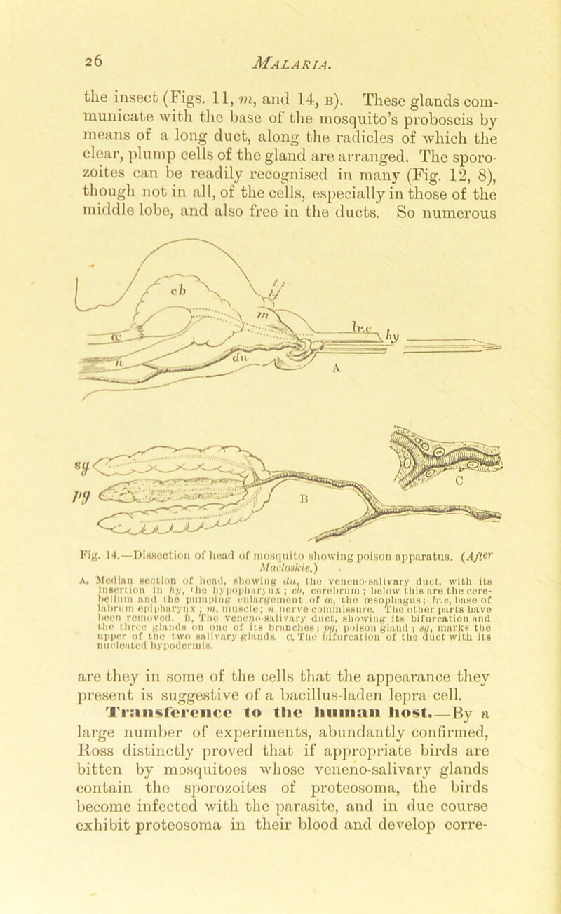 the insect (Figs. 11, in, and 14, b). These glands com- municate with the base of the mosquito’s proboscis by means of a long duct, along the radicles of which the clear, plump cells of the gland are arranged. The sporo- zoites can be readily recognised in many (Fig. 12, 8), though not in all, of the cells, especially in those of the middle lobe, and also free in the ducts. So numerous Fig. 14.—Dissection ofliead of mosquito showing poison apparatus. (After Macloslcie.) a. Median section of head, showing du. the veneno-salivary duct, with its insertion in ////, »he hypopluirynx ; cb, cerebrum; below this are the cere- bellum and ihe pumping enlargement of as, the oesophagus; Ir.e, base of labi um epipharynx ; m. muscle; n.nerve commissure. The other parts have been removed, ft, The veneno salivary duct, showing its bifurcation and the three glands on one of its brnnehos; pa, poison gland ; sa, marks the upper of the two salivary glands, o, The bifurcation of the duct with its nucleated hypodermis. are they in some of the cells that the appearance they present is suggestive of a bacillus-laden lepra cell. Transference to tlie human host.—By a large number of experiments, abundantly confirmed, Ross distinctly proved that if appropriate birds are bitten by mosquitoes whose veneno-salivary glands contain the sporozoites of proteosoma, the birds become infected with the parasite, and in due course exhibit proteosoma in their blood and develop corre-