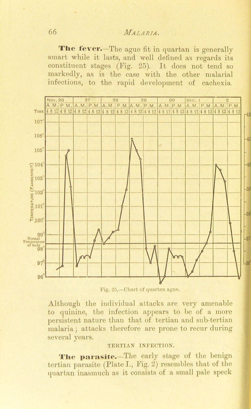 Temperature (Fahrenheit) Tlie fever.—The ague fit in quartan is generally smart while it lasts, and well defined as regards its constituent stages (Fig. 25). It does not tend so markedly, as is the case with the other malarial infections, to the rapid development of cachexia. Although the individual attacks are very amenable to quinine, the infection appears to be of a more persistent nature than that of tertian and sub-tertian malaria; attacks therefore are prone to recur during several years. TERTIAN INFECTION. The parasite.—The early stage of the benign tertian parasite (Plate I., Fig. 2) resembles that of the quartan inasmuch as it consists of a small pale speck