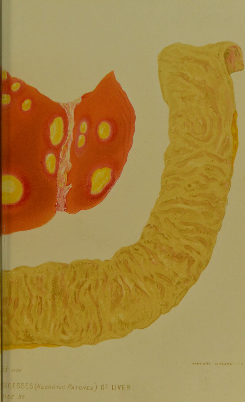 v£.s) OF LIVER *Gf 3.9