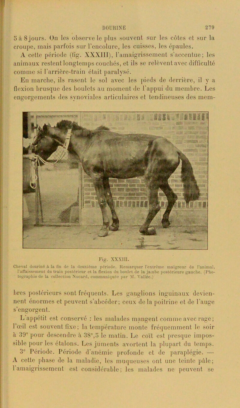 5 à 8 jours. Un les observe le plus souvent sur les côtes et sur la croupe, mais parfois sur l’encolure, les cuisses, les épaules. A cette période (fig. XXX111), l’amaigrissement s’accentue; les animaux restent longtemps couchés, et ils se relèvent avec difficulté comme si l’arrière-train était paralysé. En marche, ils rasent le sol avec les pieds de derrière, il y a flexion brusque des boulets au moment de l’appui du membre. Les engorgements îles synoviales articulaires et tendineuses des mem- Fig. XXXIII. Cheval douriné à la lin de la deuxième période. Remarquer l’extrême maigreur de l'animal, l'affaissement du train postérieur et la flexion du boulet de la jambe postérieure gauche. (Pho- tographie de la collection Nocard, communiquée par M. Vallée.) lires postérieurs sont fréquents. Les ganglions inguinaux devien- nent énormes et peuvent s’abcéder; ceux delà poitrine et de l’auge s’engorgent. L appétit est conservé : les malades mangent comme avec rage; 1 œil est souvent fixe; la température monte fréquemment le soir à 39° pour descendre à 38°,5 le matin. Le coït est presque impos- sible pour les étalons. Les juments avortent la plupart du temps. 3° Période. Période d’anémie profonde et de paraplégie. — A cette phase de la maladie, les muqueuses ont une teinte pale; l’amaigrissement est considérable; les malades ne peuvent se