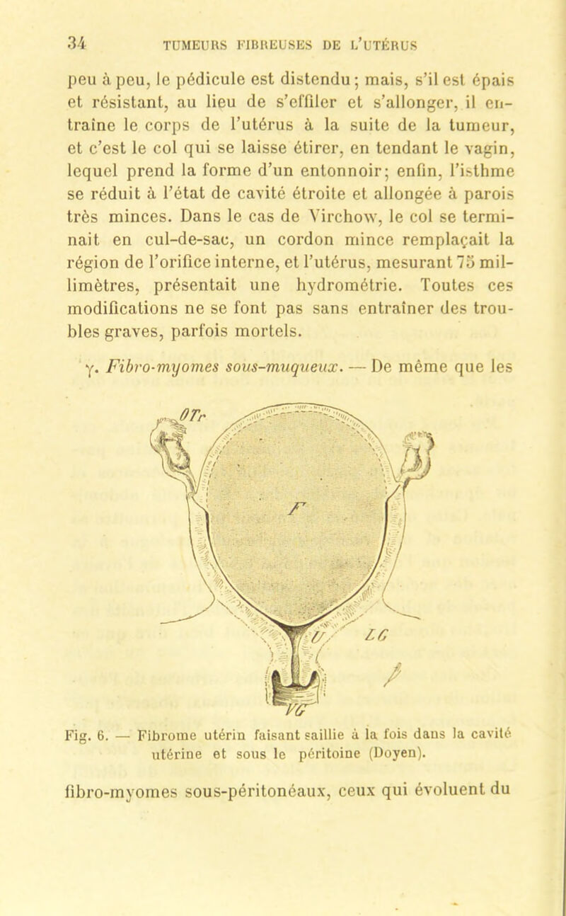 peu à peu, le pédicule est distendu; mais, s’il est épais et résistant, au lieu de s’effiler et s’allonger, il en- traîne le corps de l’utérus à la suite de la tumeur, et c’est le col qui se laisse étirer, en tendant le vagin, lequel prend la forme d’un entonnoir; enfin, l’isthme se réduit à l’état de cavité étroite et allongée à parois très minces. Dans le cas de Virchow, le col se termi- nait en cul-de-sac, un cordon mince remplaçait la région de l’orifice interne, et l’utérus, mesurant 7o mil- limètres, présentait une hydrométrie. Toutes ces modifications ne se font pas sans entraîner des trou- bles graves, parfois mortels. y. Fibro-myomes sous-muqueux. — De même que les Fig. 6. — Fibrome utérin faisant saillie à la fois dans la cavité utérine et sous le péritoine (Doyen). fibro-invomes sous-péritonéaux, ceux qui évoluent du