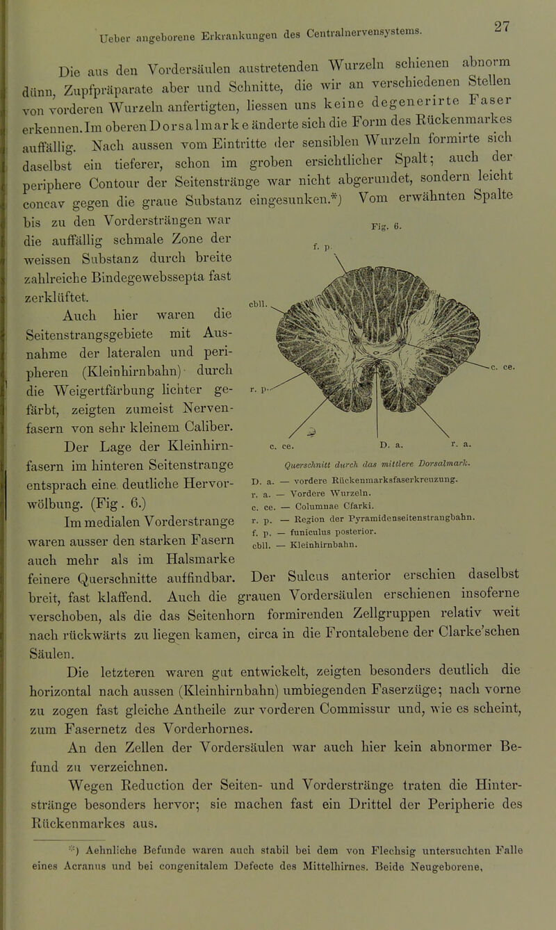 Die aus den Vordersäulen austretenden Wurzeln schienen abnorm dünn Zupfpräparate aber und Schnitte, die Avir an verschiedenen Stellen von vorderen Wurzeln anfertigten, liessen uns keine degenerirte Faser .kennen Im oberenDorsalmark e änderte sich die Form des Rückenmarkes anffällig. Nach aussen vom Eintritte der sensiblen Wurzeln formirte sich daselbst ein tieferer, schon im groben ersichtlicher Spalt; auch der periphere Contour der Seitenstränge war nicht abgerundet, sondern Jeicht concav gegen die graue Substanz eingesunken.*) bis zu den Vordersträngen war die auffällig schmale Zone der weissen Substanz durch breite zahlreiche Bindegewebssepta fast zerklüftet. Auch hier waren die Seitenstrangsgebiete mit Aus- nahme der lateralen und peri- pheren (Kleinhirnbahn) durch die Weigertfärbung hchter ge- fäz-bt, zeigten zumeist Nerven- fasern von sehr kleinem Caliber. Der Lage der Kleinhirn- fasern im hinteren Seitenstrange entsprach eine deutliche Hervor- wölbung. (Fig. 6.) Im medialen Vorderstrange waren ausser den starken Fasern auch mehr als im Halsmarke feinere Querschnitte auffindbar. Der Sulcus anterior erschien daselbst breit, fast klaffend. Auch die grauen Vordersäulen erschienen insoferne verschoben, als die das Seitenhorn formirenden Zellgruppen relativ weit nach rückwärts zu liegen kamen, circa in die Frontalebene der Clarke'scben Säulen. Die letzteren waren gut entwickelt, zeigten besonders deutlich die horizontal nach aussen (Kleinhirnbahn) umbiegenden Faserzüge; nach vorne zu zogen fast gleiche Antheile zur vorderen Commissur und, wie es scheint, zum Fasernetz des Vorderhornes. An den Zellen der Vordersäulen war auch hier kein abnormer Be- fund zu verzeichnen. Wegen Reduction der Seiten- und Vorderstränge traten die Hinter- stränge besonders hervor; sie machen fast ein Drittel der Peripherie des Rückenmarkes aus. Vom erwähnten Spalte Fi£ f. p. cbll. r. p D. a. r. a. Querschnitt durch das mitllei-e Dorsalmarlc. D. a. — vordere Rückenmarksfaserkreuznng. r. a. — Vordere Wurzeln, c. ce. — Columuae Cfarki. r. p. Resion der Pyramldenseitenstrangbahn. f. p. _ funiculus posterior, cbll. — Kleinhirnbahn. ■'■'•) Aehnliche Befunde waren auch stabil bei dem von Flechsig untersuchten Falle eines Acranus und bei congenitalem Defecte des Mittelhirnes. Beide Neugeborene,