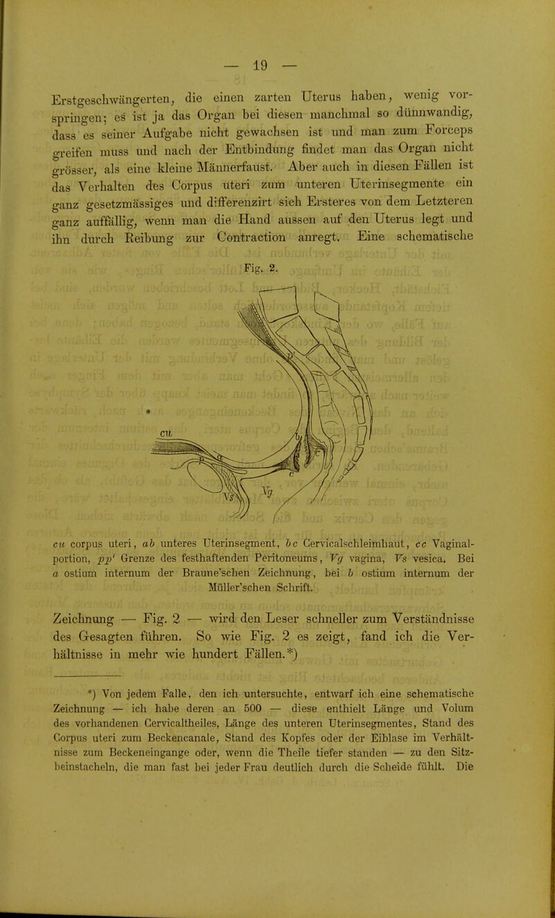 Erstgeschwängerten, die einen zarten Uterus haben, wenig vor- springen; es ist ja das Organ bei diesen manchmal so dünnwandig, dass es seiner Aufgabe nicht gewachsen ist und man zum Forceps greifen muss und nach der Entbindung findet man das Organ nicht o-rösser, als eine kleine Männerfaust. Aber auch in diesen Fällen ist das Verhalten des Corpus uteri zum unteren Uterinsegmente em ganz gesetzmässiges und dilFerenzirt sich Ersteres von dem Letzteren ganz auffäUig, wenn man die Hand aussen auf den Uterus legt und ihn durch Reibimg zur Gontraction anregt. Eine schematische 'n Fig. 2. cu corpus uteri, ab unteres Uterinsegment, bc Cervicalschleimbaut, cc Vaginal- portion, pp' Grenze des festhaftenden Peritoneums, Vg vagina, Vs vesica. Bei a ostium internum der Braune'schen Zeichnung, bei b ostium internum der Müller'schen Schrift. Zeichnung — Fig. 2 — wird den Leser schneller zum Verständnisse des Gesagten führen. So wie Fig. 2 es zeigt, fand ich die Ver- hältnisse in mehr wie hundert Fällen.*) *) Von jedem Falle, den ich untersuchte, entwarf ich eine schematische Zeichnung — ich habe deren an 500 — diese enthielt Länge und Volum des vorhandenen Gervicaltheiles, Länge des unteren Uterinsegmentes, Stand des Corpus uteri zum Beckencanale, Stand des Kopfes oder der Eiblase im Verhält- nisse zum Beckeneingange oder, wenn die Theile tiefer standen — zu den Sitz- beinstacheln, die man fast bei jeder Frau deutlich durch die Scheide fühlt. Die