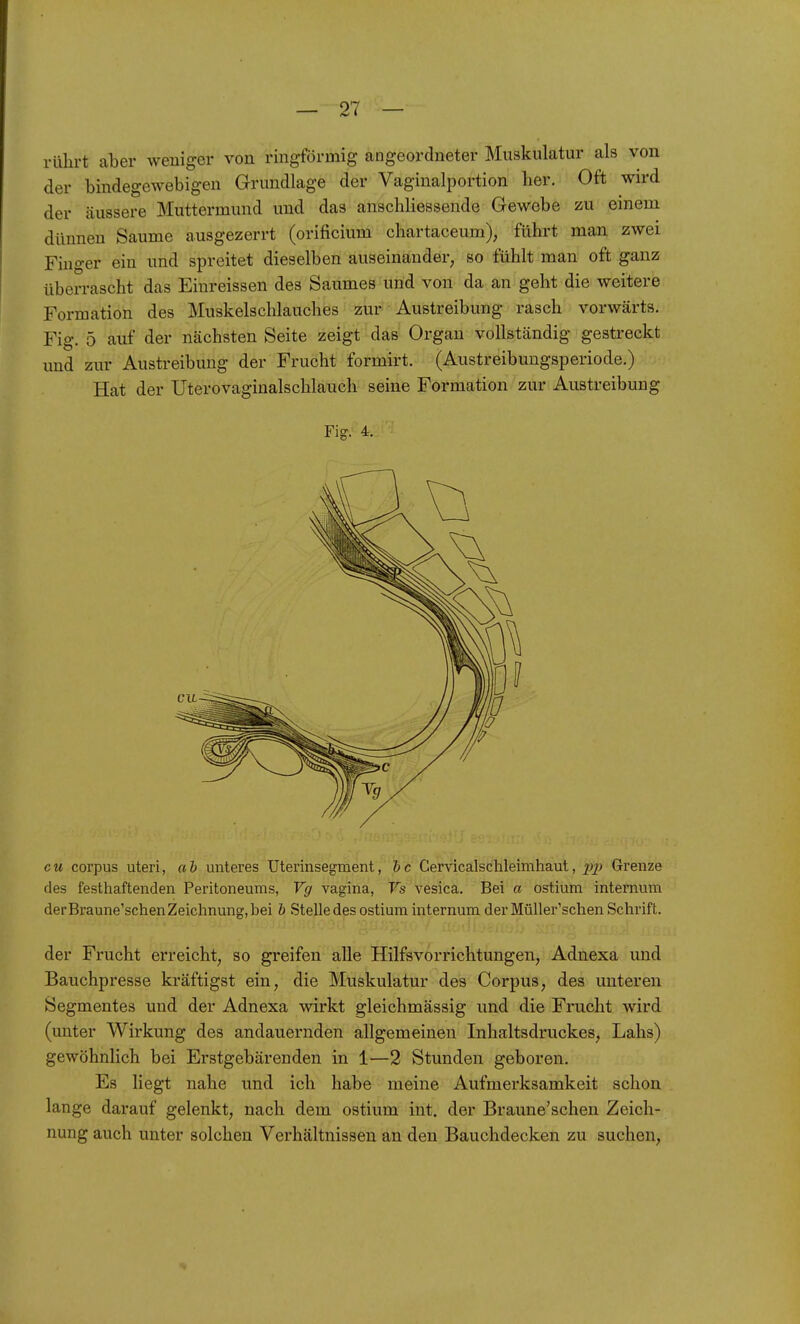rülirt aber weniger von ringförmig angeordneter Muskulatur als von der bindegewebigen Grundlage der Vaginalportion her. Oft wn-d der cäussere Muttermund und das anschliessende Gewebe zu einem dünnen Saume ausgezerrt (orificium chartaceum), führt man zwei Finger ein und spreitet dieselben auseinander, so fühlt man oft ganz überrascht das Einreissen des Saumes und von da an geht die weitere Formation des Muskelschlauches zur Austreibung rasch vorwärts. Fig. 5 auf der nächsten Seite zeigt das Organ vollständig gestreckt imd zur Austreibung der Frucht formirt. (Austreibuugsperiode.) Hat der Utero vaginalschlauch seine Formation zur Austreibung Fig. 4. cu corpus uteri, ah unteres Uterinsegment, hc Cervicalschleimhaut, Grenze des festhaftenden Peritoneums, Vg vagina, Ts vesica. Bei a ostium intemum derBraune'schenZeichnung, bei h Stelle des ostium intemum. der Müller'schen Schrift. der Frucht erreicht, so greifen alle HilfsVorrichtungen, Adnexa und Bauchpresse kräftigst ein, die Muskulatur des Corpus, des unteren Segmentes und der Adnexa wirkt gleichmässig und die Frucht wird (unter Wirkung des andauernden allgemeinen Inhaltsdruckes, Lahs) gewöhnlich bei Erstgebärenden in 1—2 Stunden geboren. Es liegt nahe und ich habe meine Aufmerksamkeit schon lange darauf gelenkt, nach dem ostium int. der Braune'schen Zeich- nung auch unter solchen Verhältnissen an den Bauchdecken zu suchen,